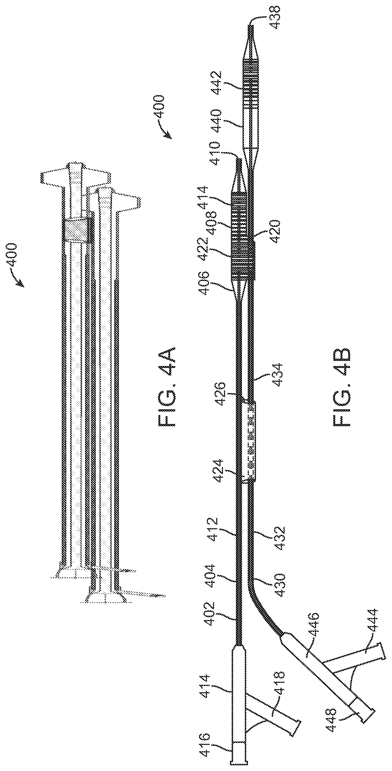 Patent US12324756 Figure 4 – System and methods for treating a bifurcation