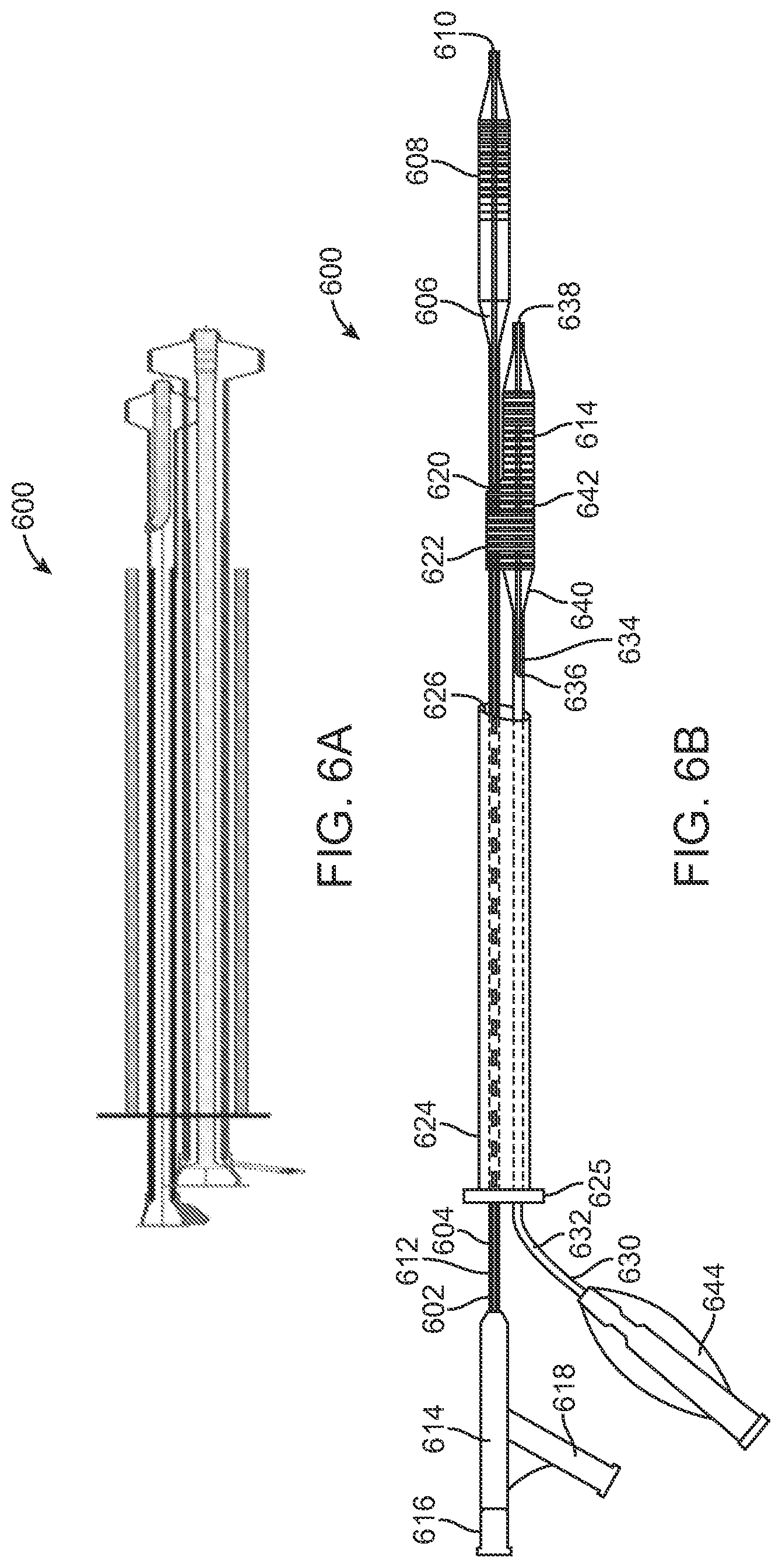 Patent US12324756 Figure 6 – System and methods for treating a bifurcation
