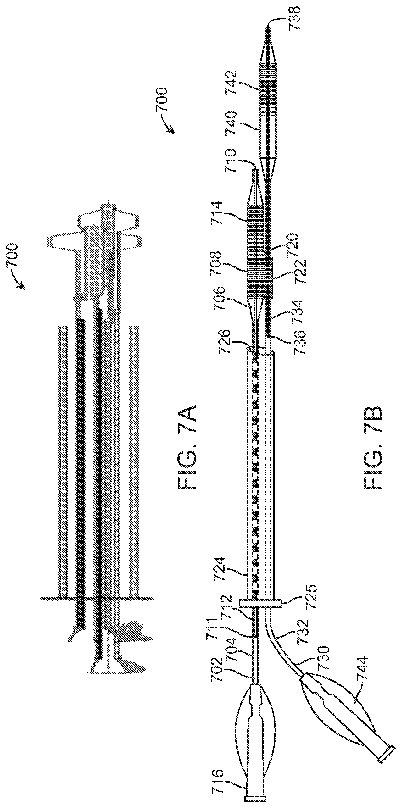 Patent US12324756 Figure 7 – System and methods for treating a bifurcation