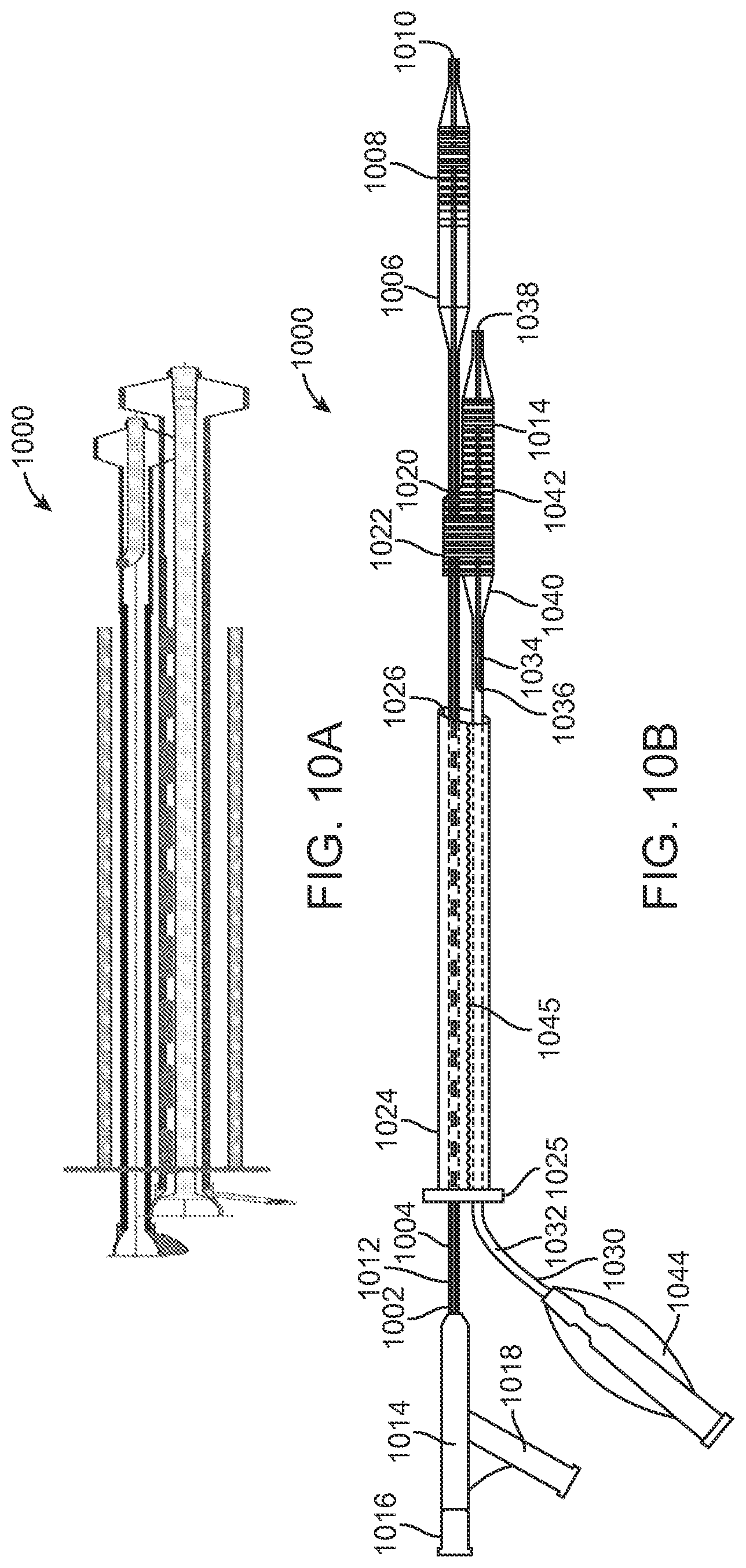 Patent US12324756 Figure 10 – System and methods for treating a bifurcation