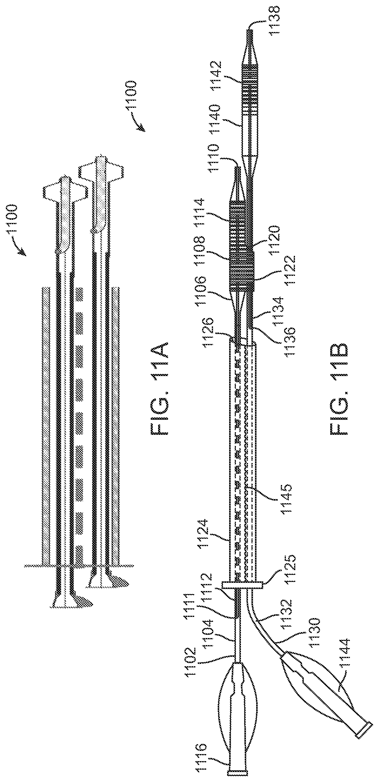 Patent US12324756 Figure 11 – System and methods for treating a bifurcation