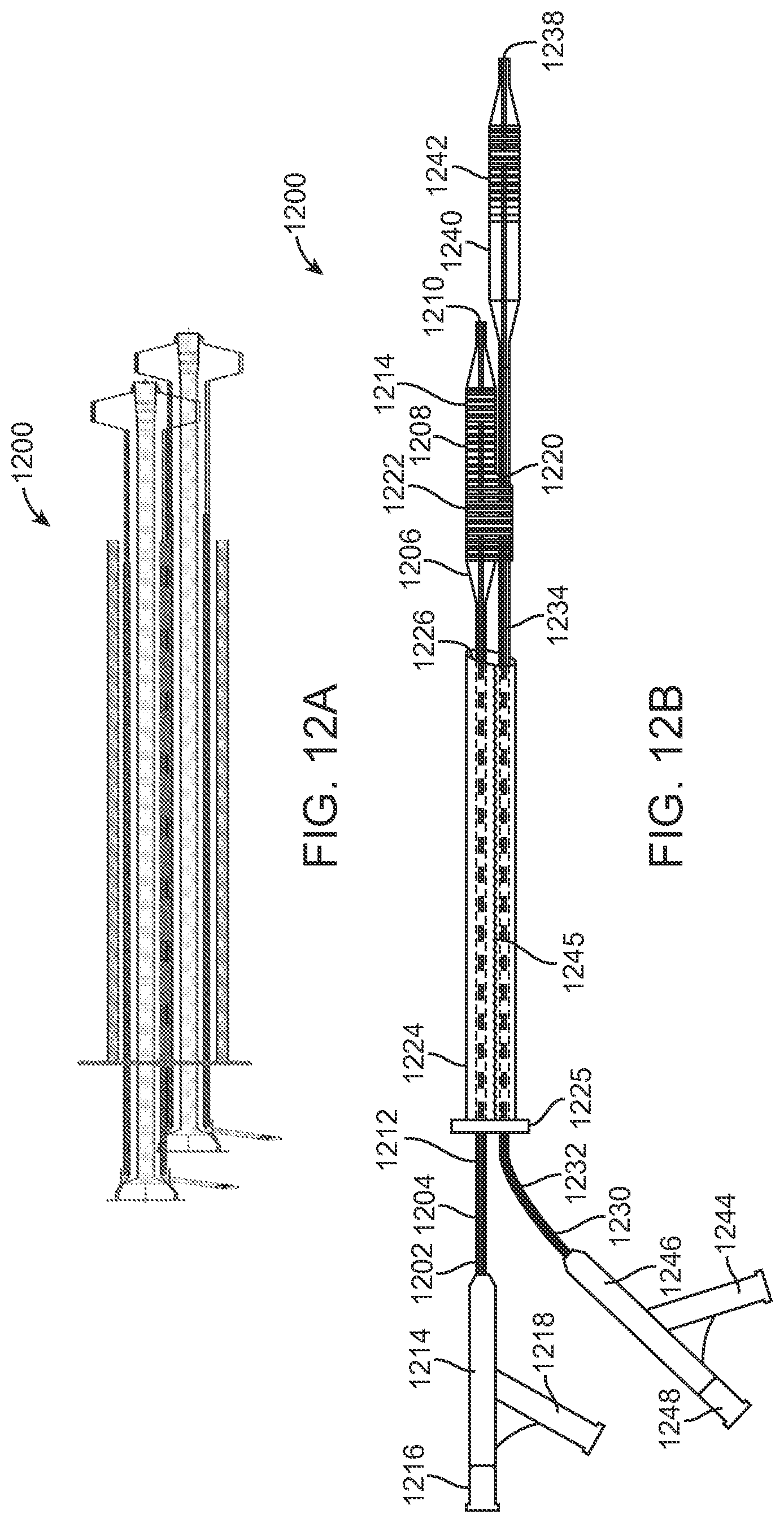 Patent US12324756 Figure 12 – System and methods for treating a bifurcation