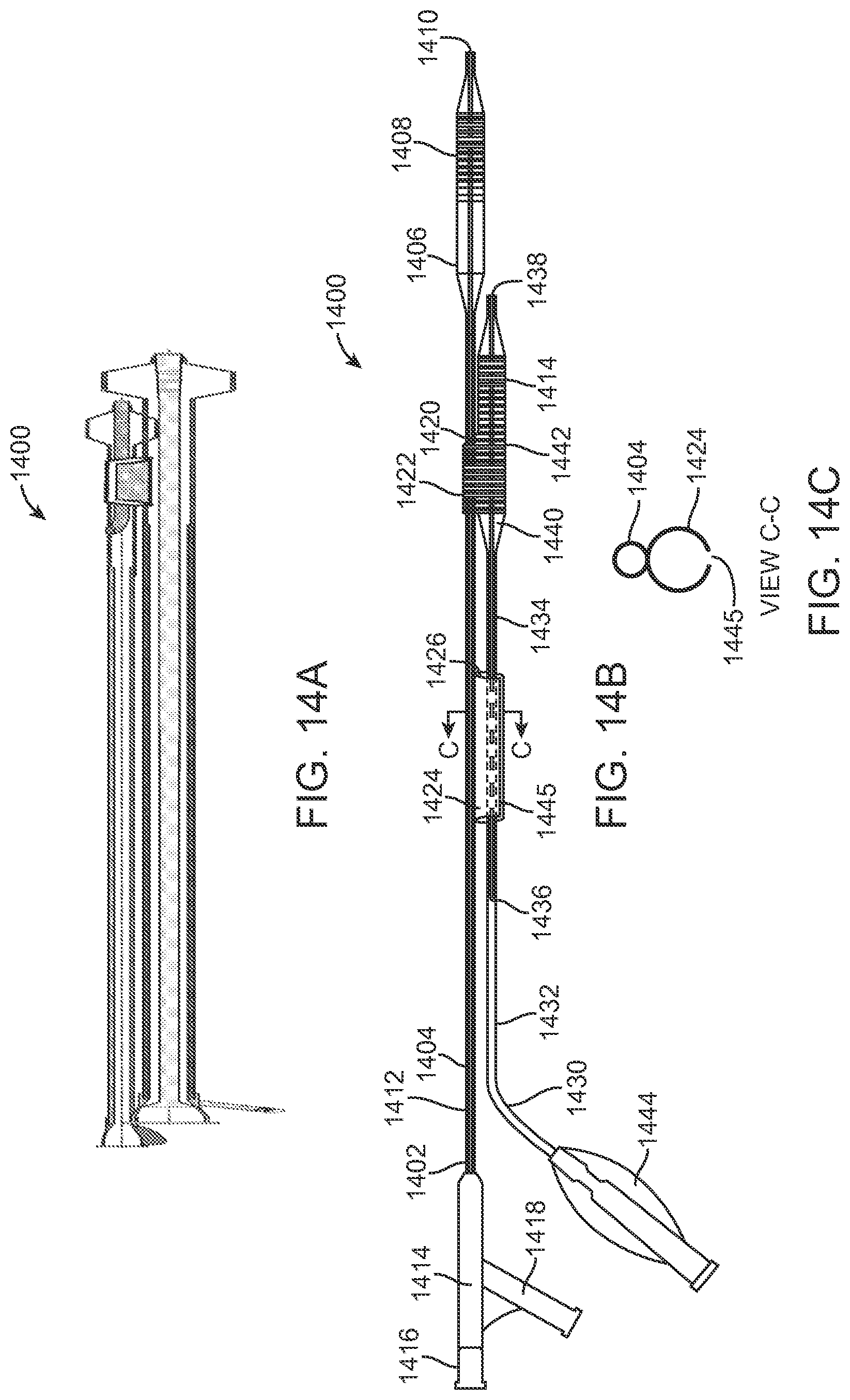 Patent US12324756 Figure 14 – System and methods for treating a bifurcation