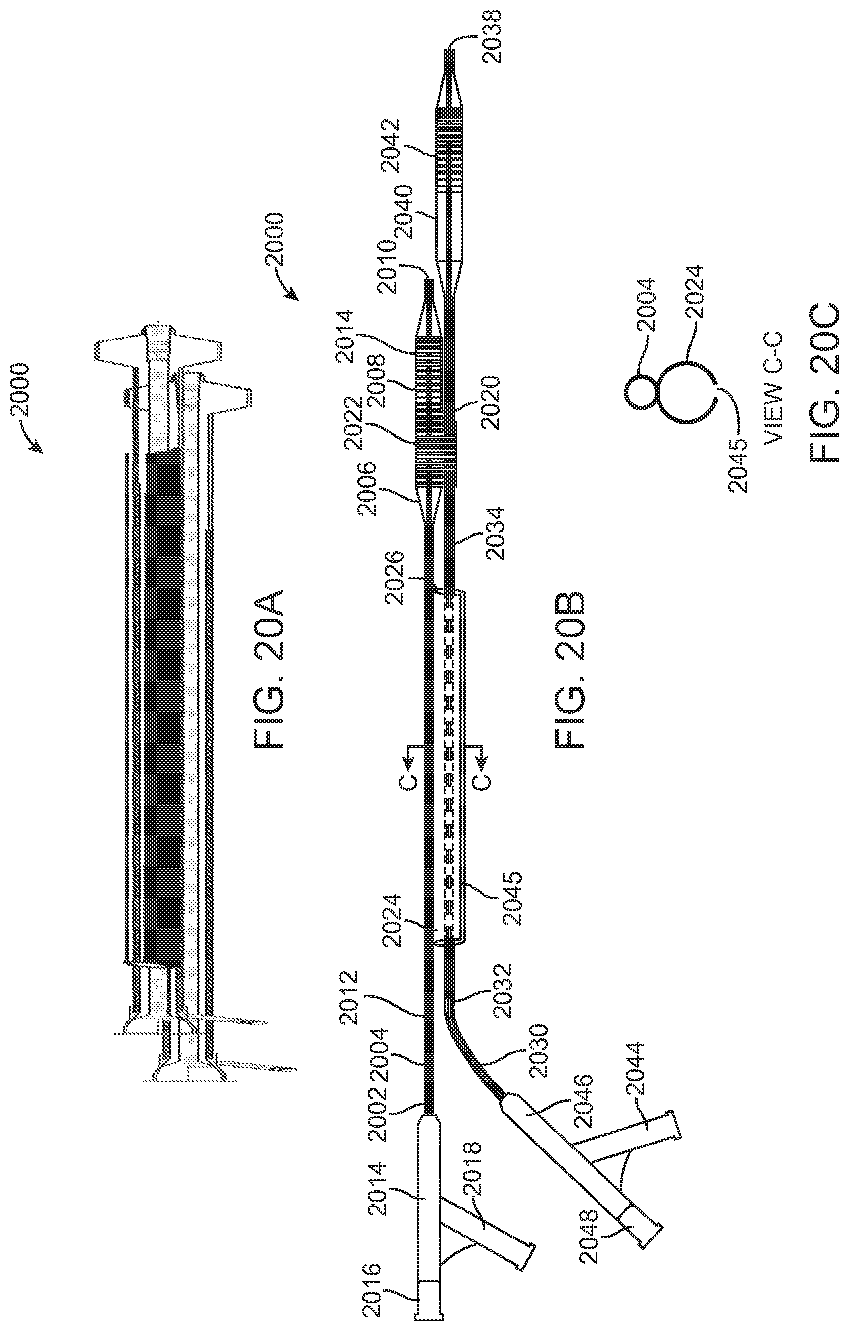Patent US12324756 Figure 20 – System and methods for treating a bifurcation