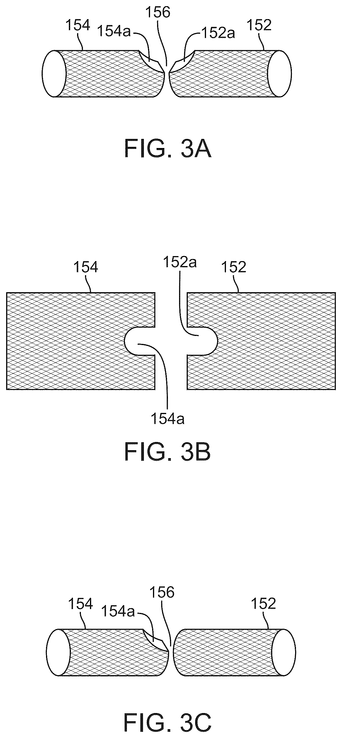 Patent US12324757 Figure 3 – Multi-stent and multi-balloon apparatus for treating bifurcations and methods of use