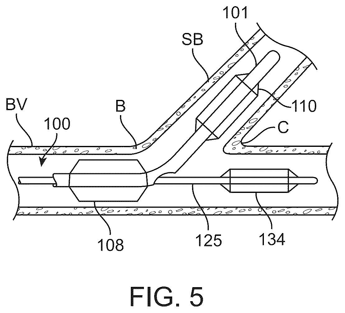 Patent US12324757 Figure 10 – Multi-stent and multi-balloon apparatus for treating bifurcations and methods of use