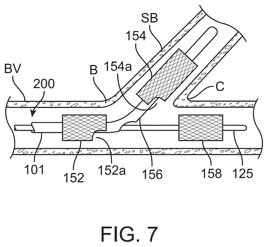 Patent US12324757 Figure 16 – Multi-stent and multi-balloon apparatus for treating bifurcations and methods of use