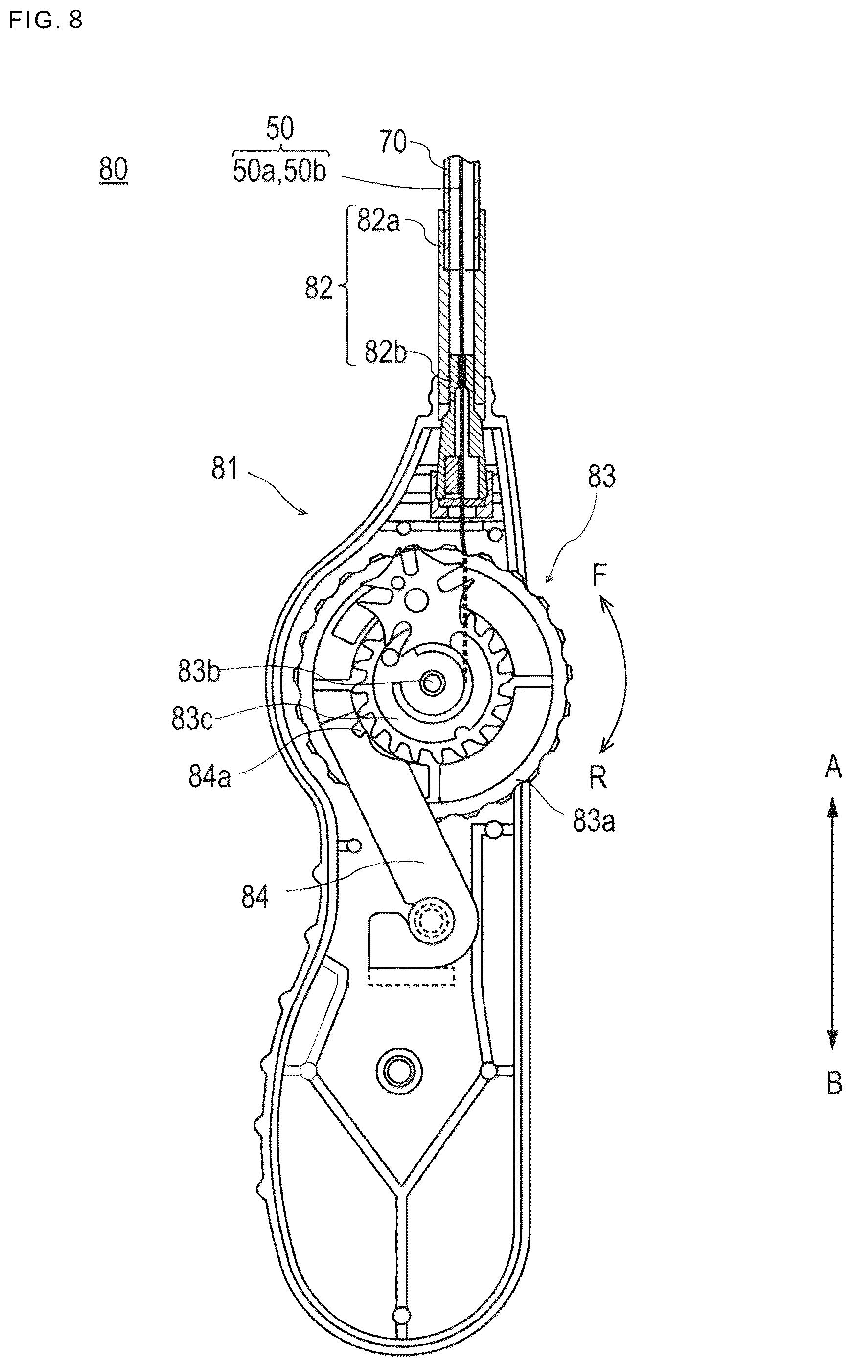 Patent US12324758 Figure 6 – Method for manufacturing stent delivery system and stent delivery system