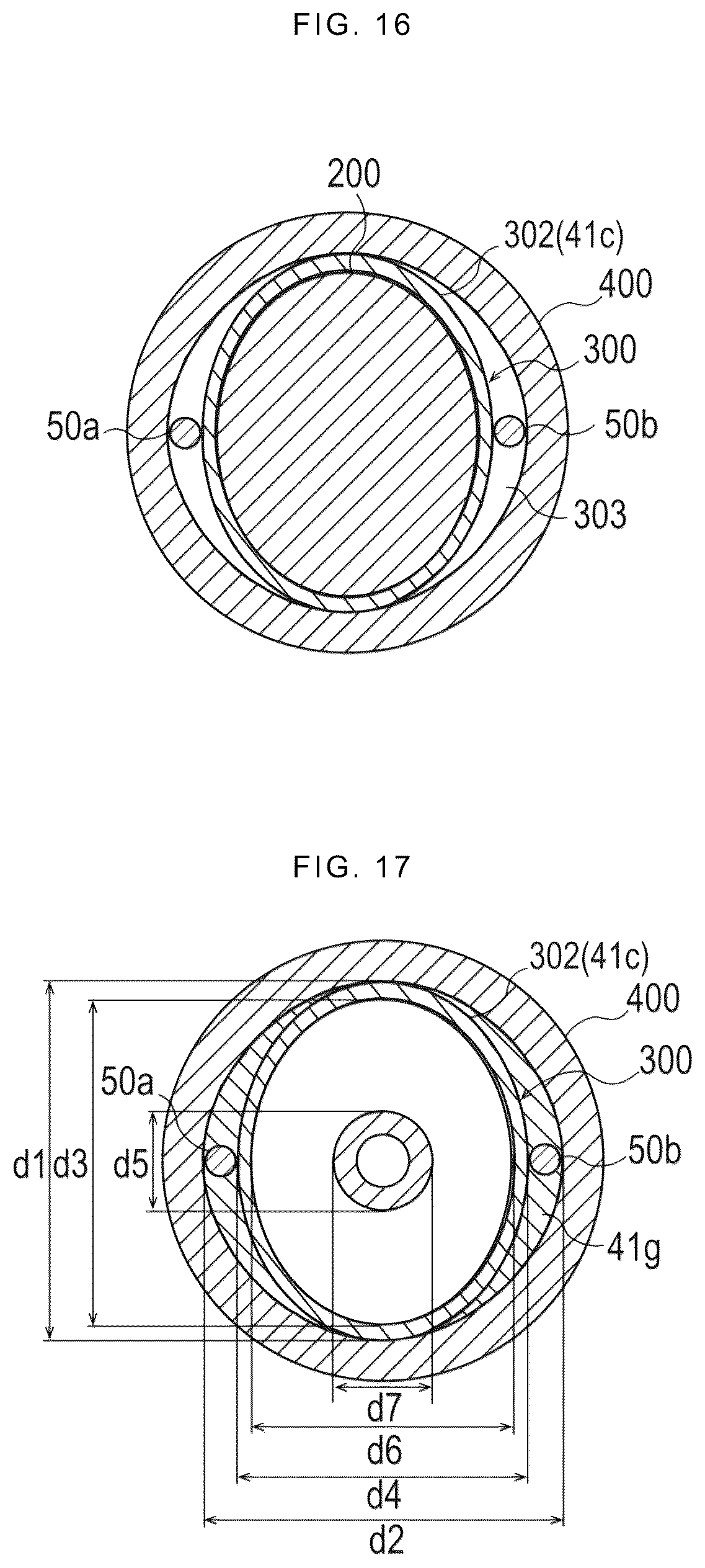 Patent US12324758 Figure 11 – Method for manufacturing stent delivery system and stent delivery system
