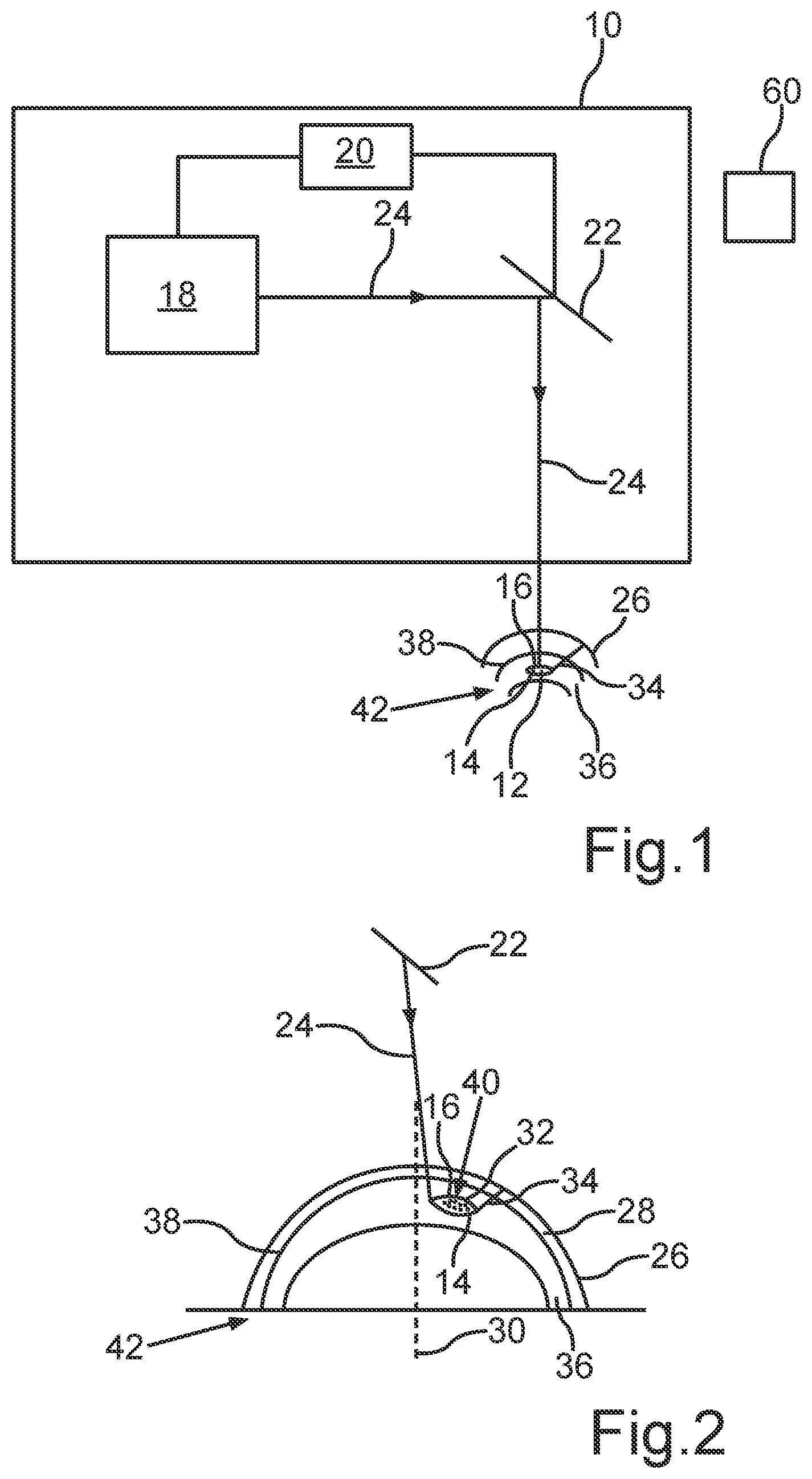 Patent US12324772 Figure 1 – Method for controlling an eye surgical laser and treatment apparatus
