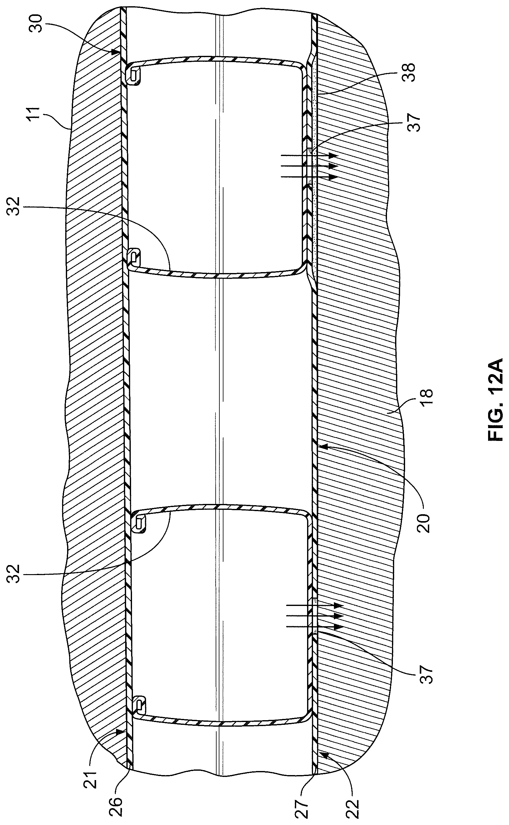 Patent US12324778 Figure 13 – Apparatus and system for lifting, moving, turning, and positioning a patient