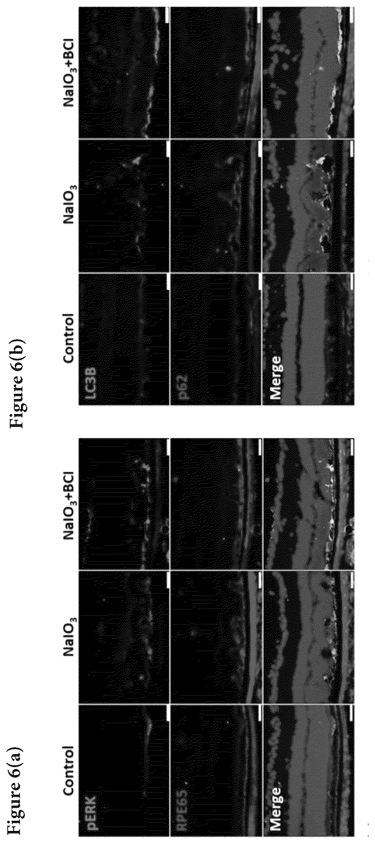 Patent US12324813 Figure 10 – Method and pharmaceutical composition for rescuing retinal degeneration