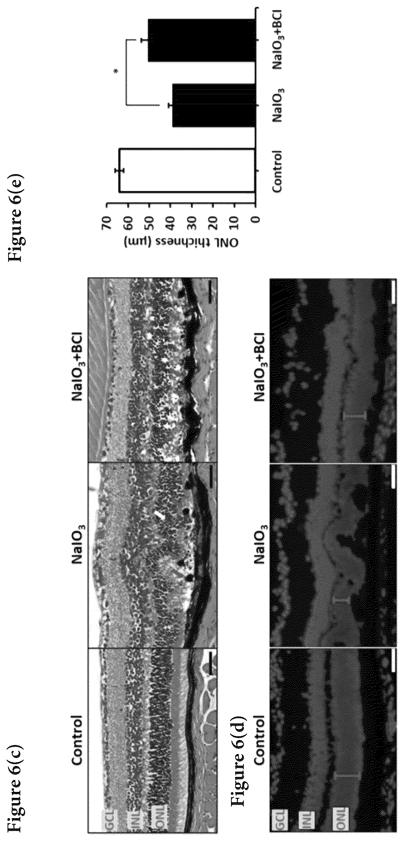 Patent US12324813 Figure 11 – Method and pharmaceutical composition for rescuing retinal degeneration