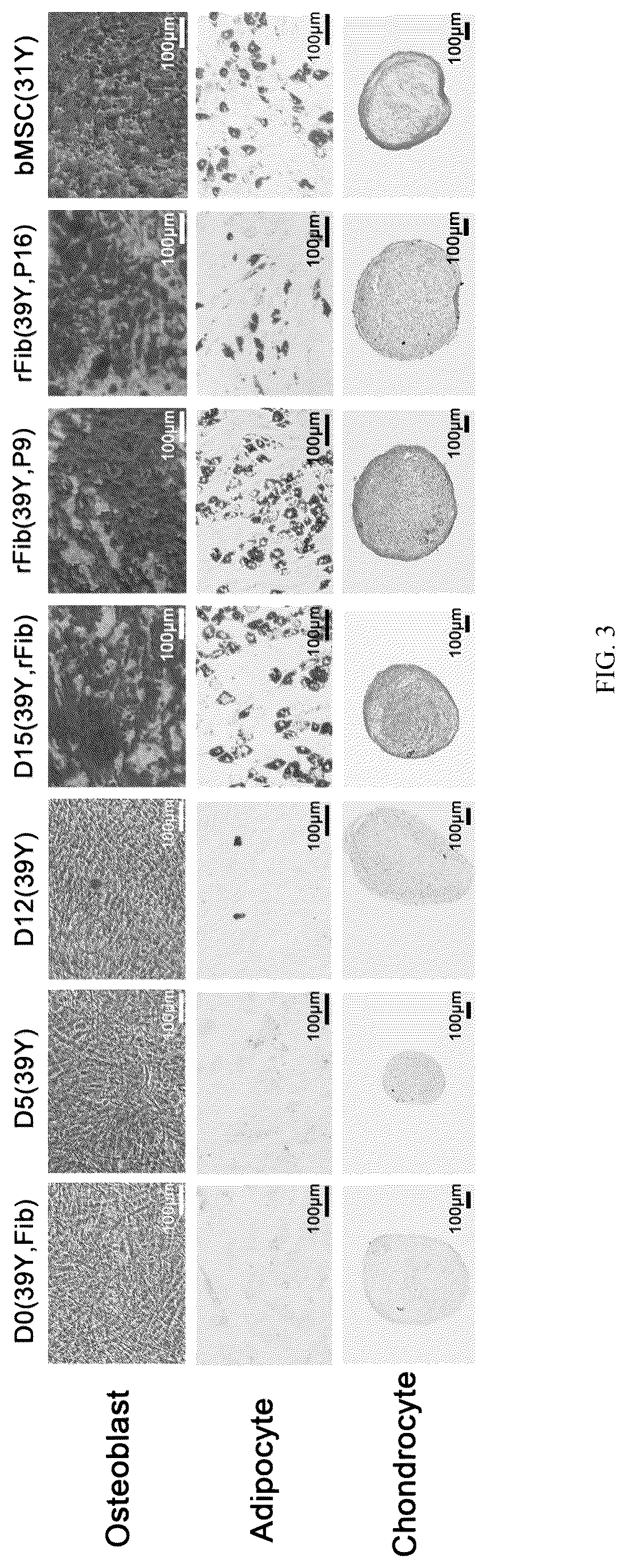 Patent US12324817 Figure 3 – Method of inducing dedifferentiation of somatic cells with small molecules to prepare rejuvenated mesenchymal stem cells and uses thereof