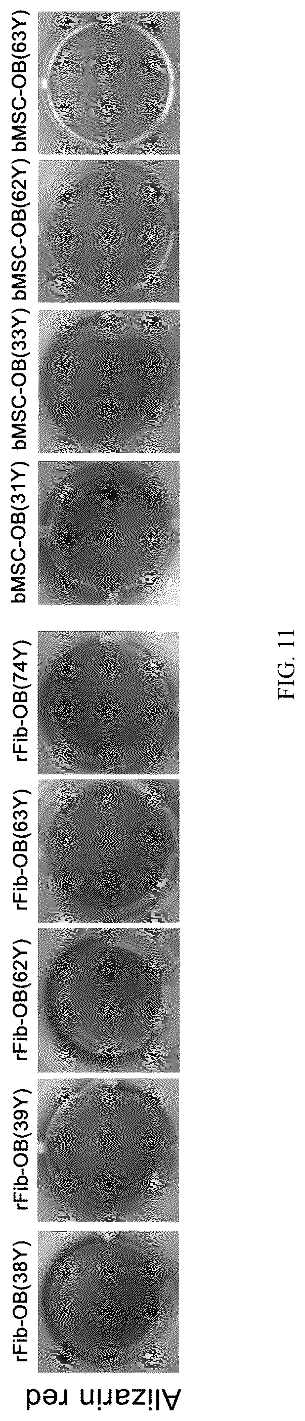 Patent US12324817 Figure 11 – Method of inducing dedifferentiation of somatic cells with small molecules to prepare rejuvenated mesenchymal stem cells and uses thereof