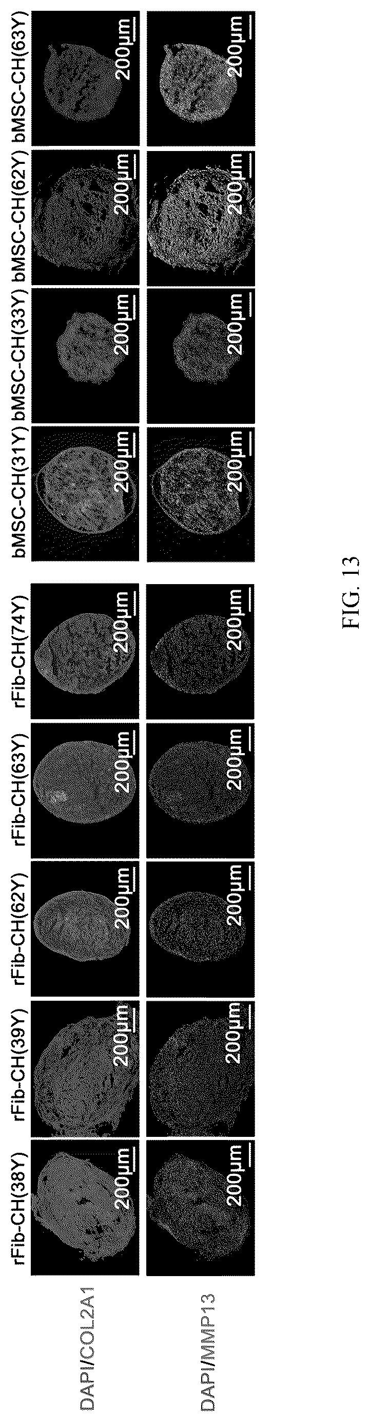 Patent US12324817 Figure 13 – Method of inducing dedifferentiation of somatic cells with small molecules to prepare rejuvenated mesenchymal stem cells and uses thereof