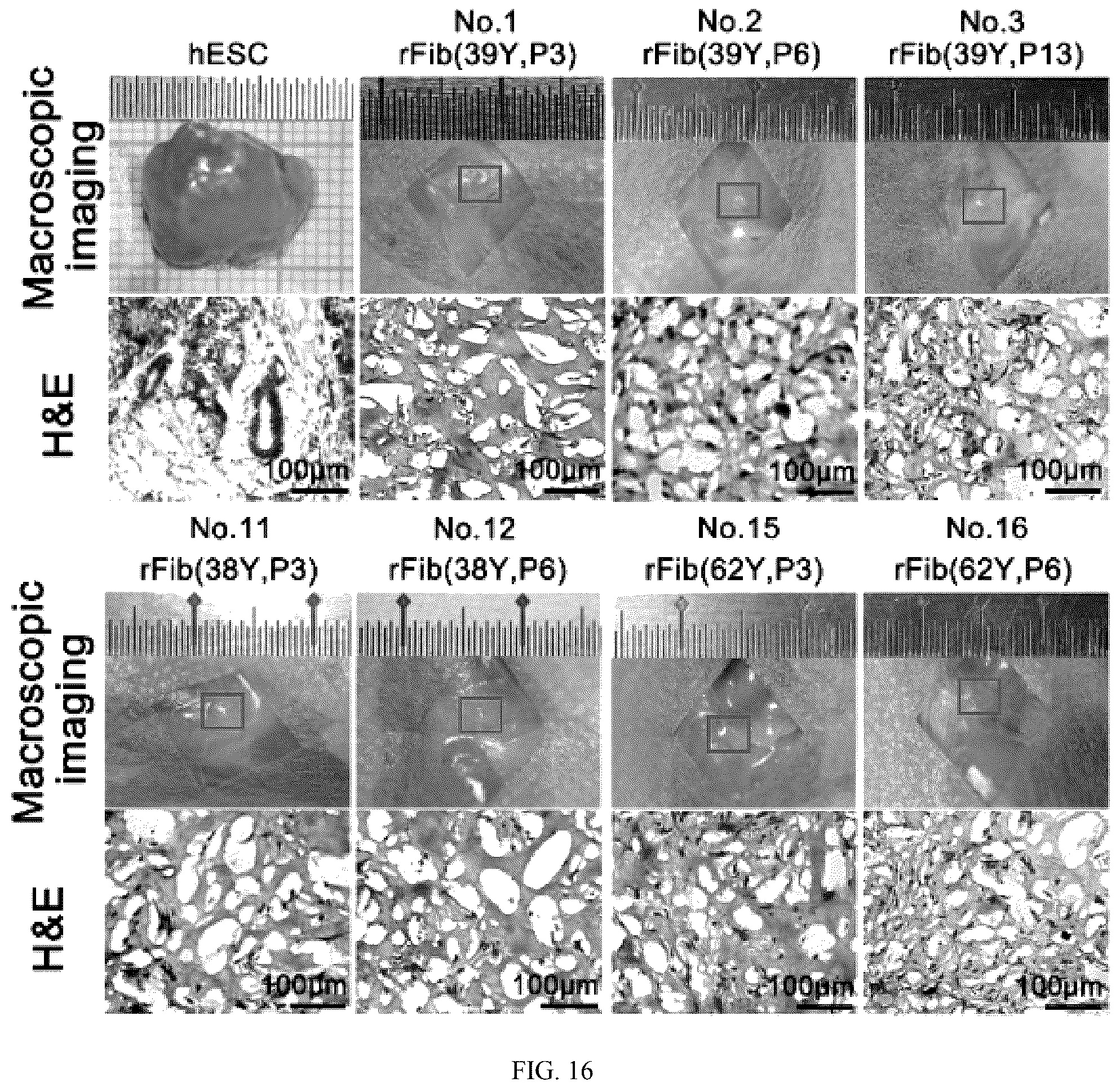 Patent US12324817 Figure 16 – Method of inducing dedifferentiation of somatic cells with small molecules to prepare rejuvenated mesenchymal stem cells and uses thereof