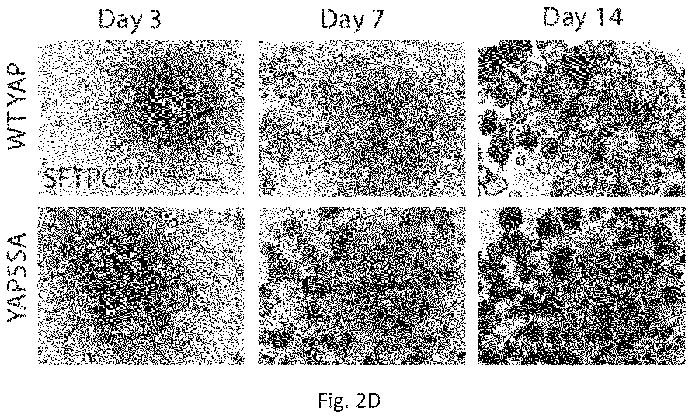 Patent US12324818 Figure 10 – Generation of alveolar epithelial type 1 (AT1) cells