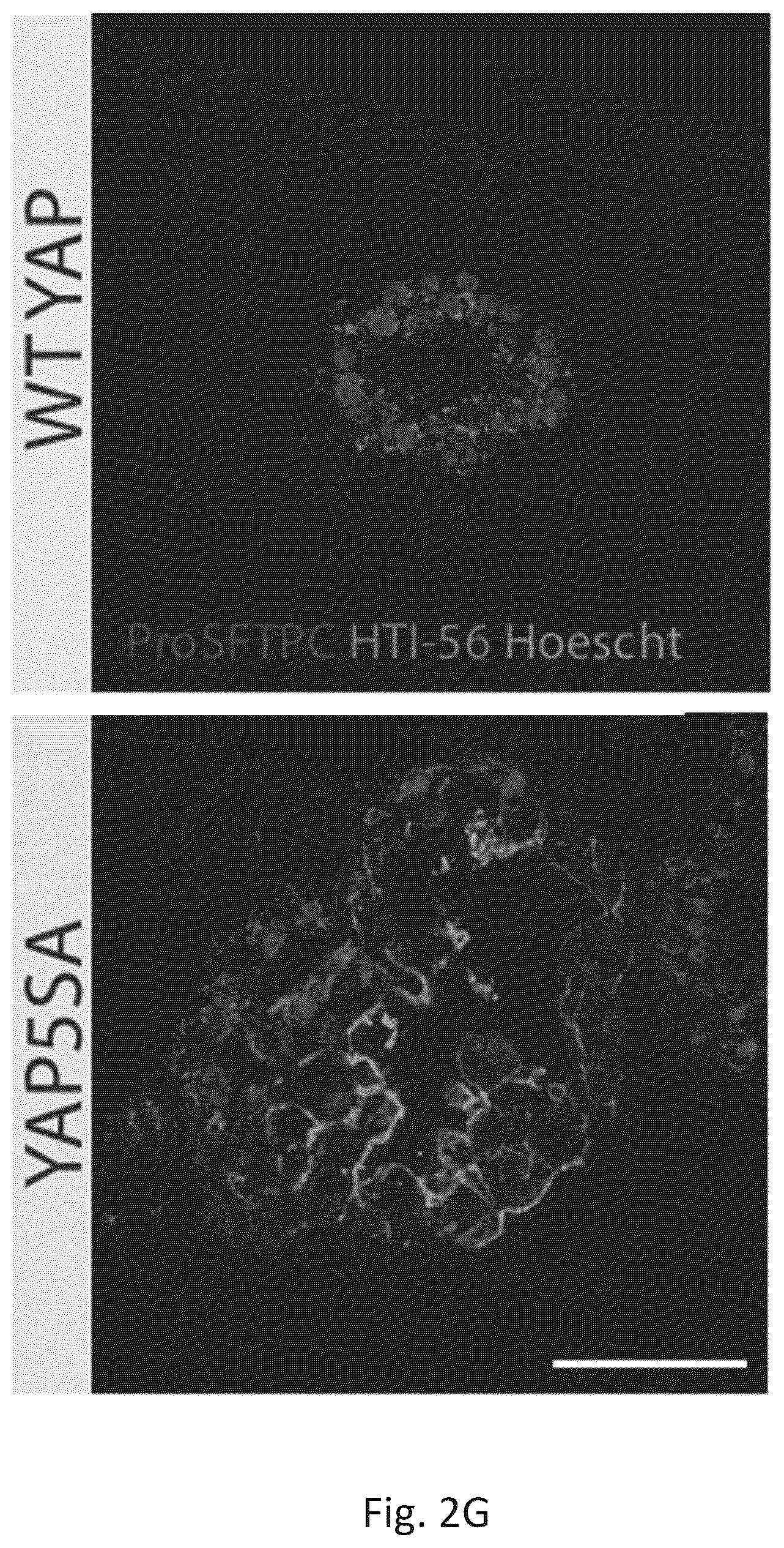 Patent US12324818 Figure 13 – Generation of alveolar epithelial type 1 (AT1) cells
