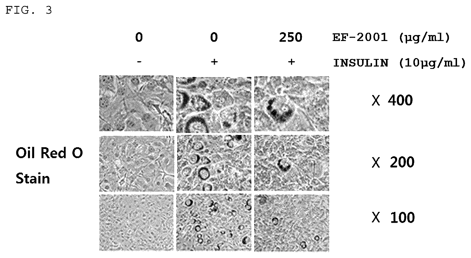 Patent US12324819 Figure 2 – Composition containing Enterococcus faecalis as active ingredient for preventing or treating obesity or metabolic syndromes induced thereby