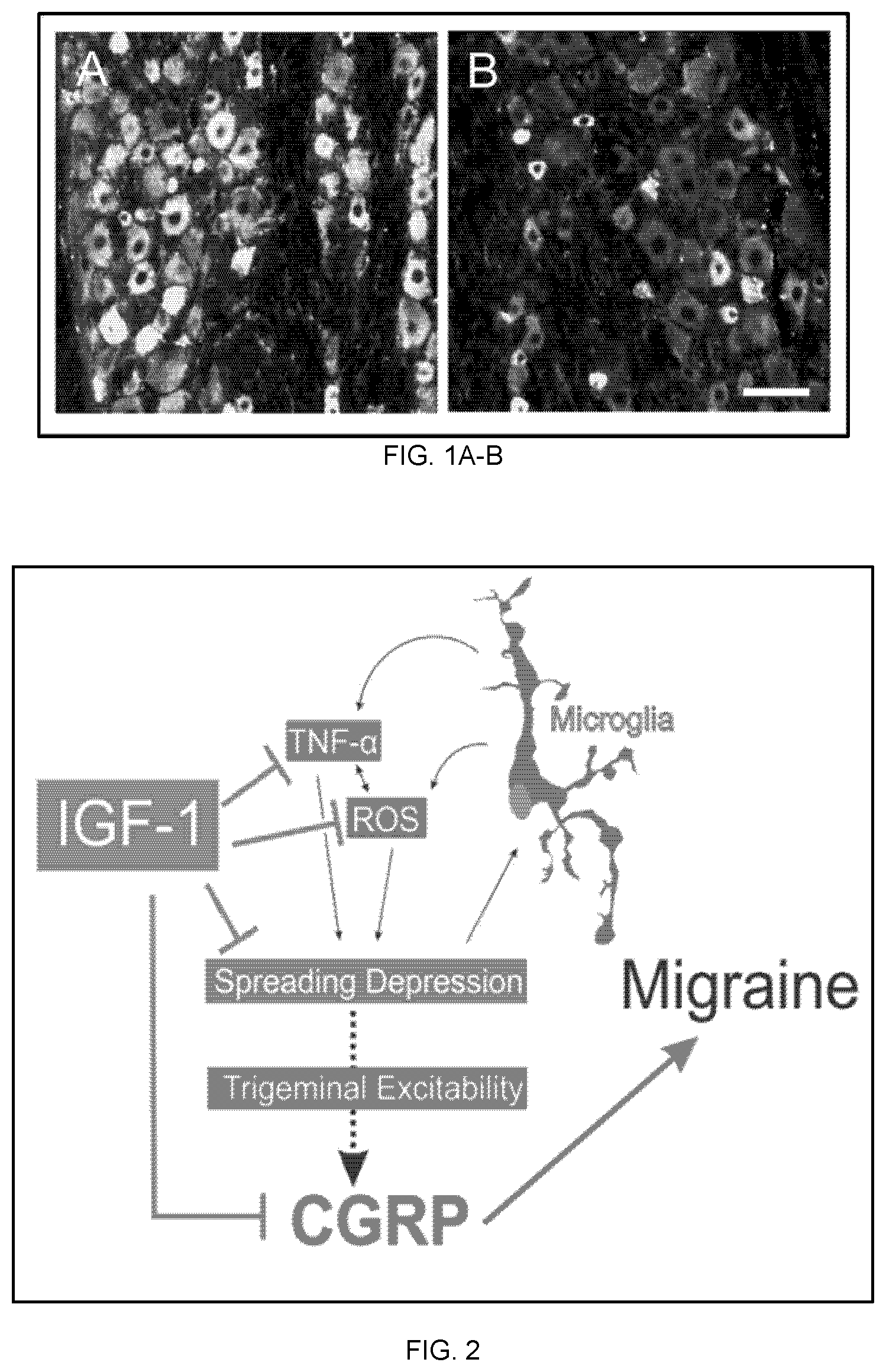 Patent US12324827 Figure 1 – Combination therapy for the treatment of migraines