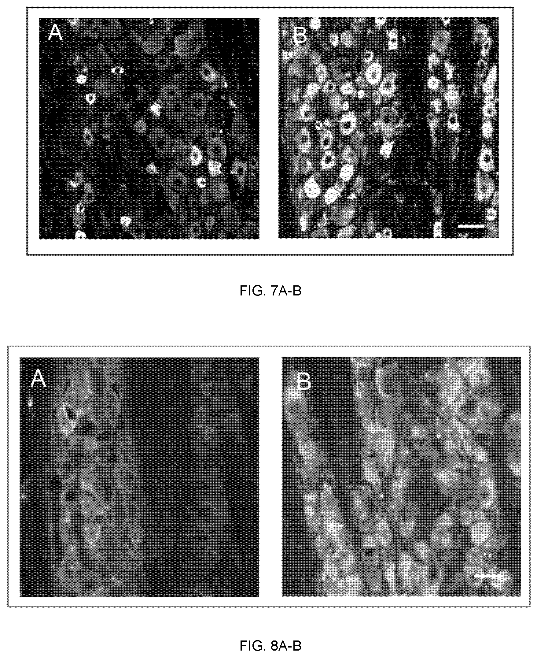 Patent US12324827 Figure 5 – Combination therapy for the treatment of migraines