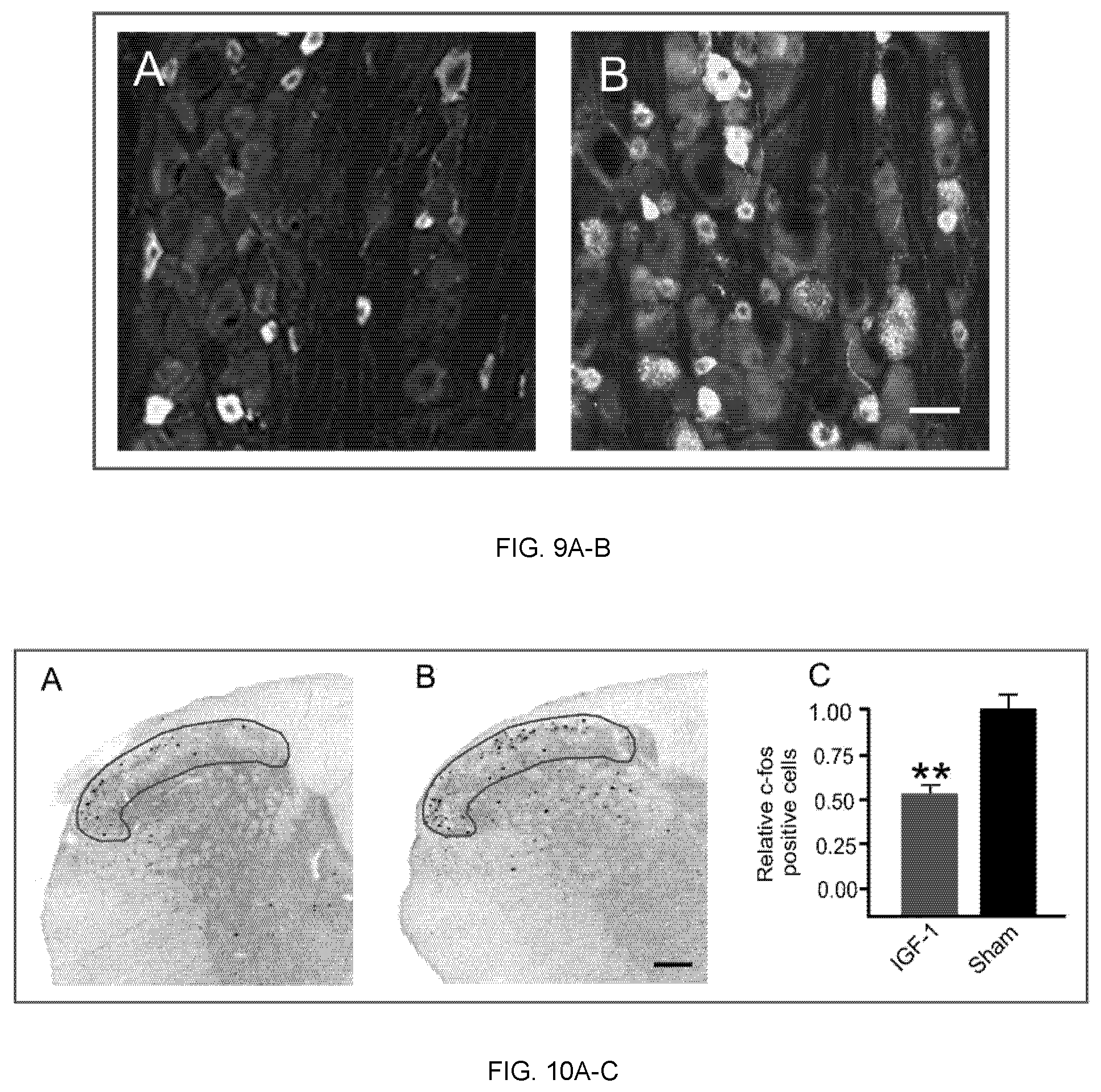 Patent US12324827 Figure 6 – Combination therapy for the treatment of migraines