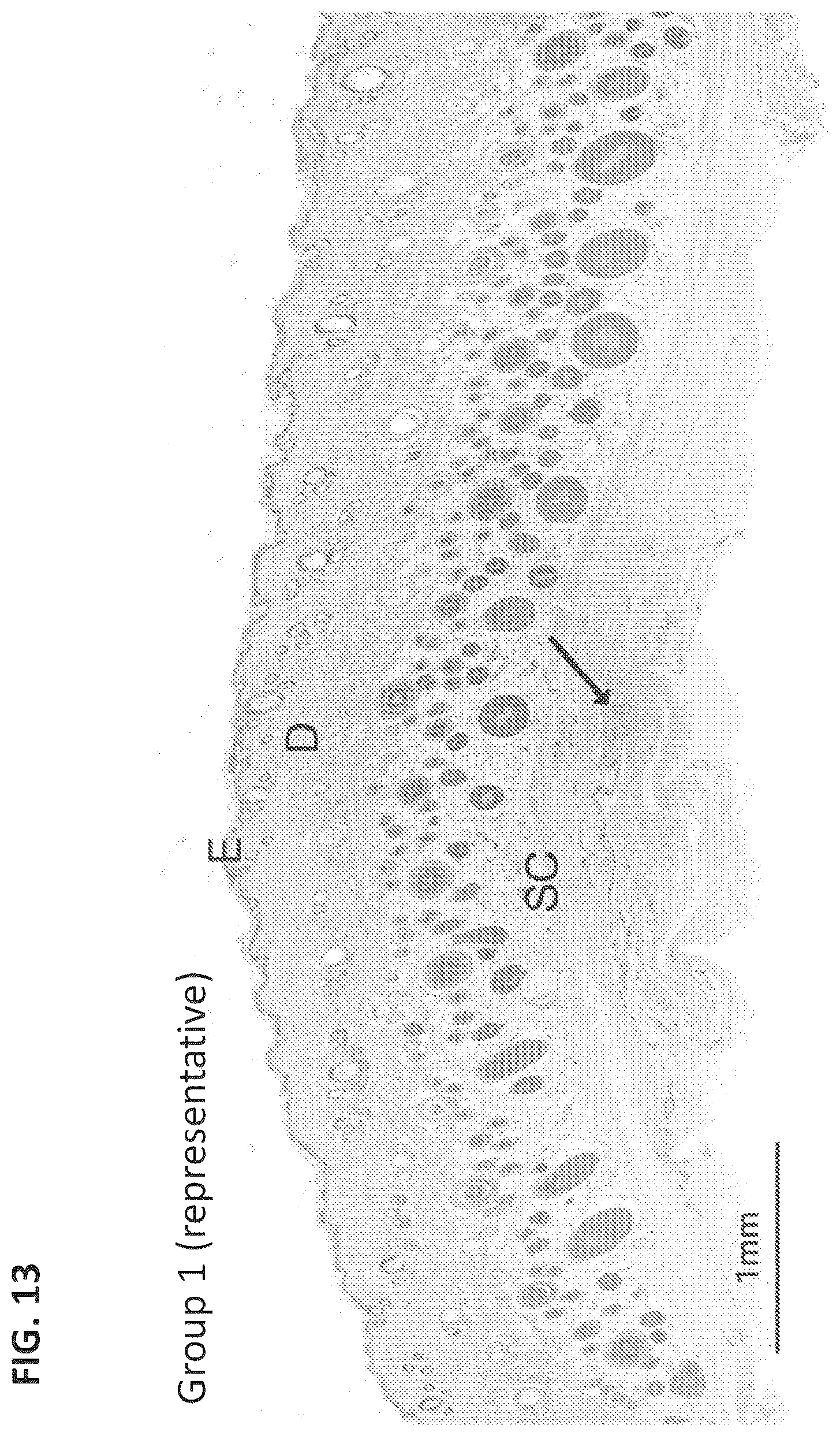 Patent US12324860 Figure 11 – Methods of treating central nervous system disorders via administration of nanoparticles of an mTOR inhibitor and an albumin