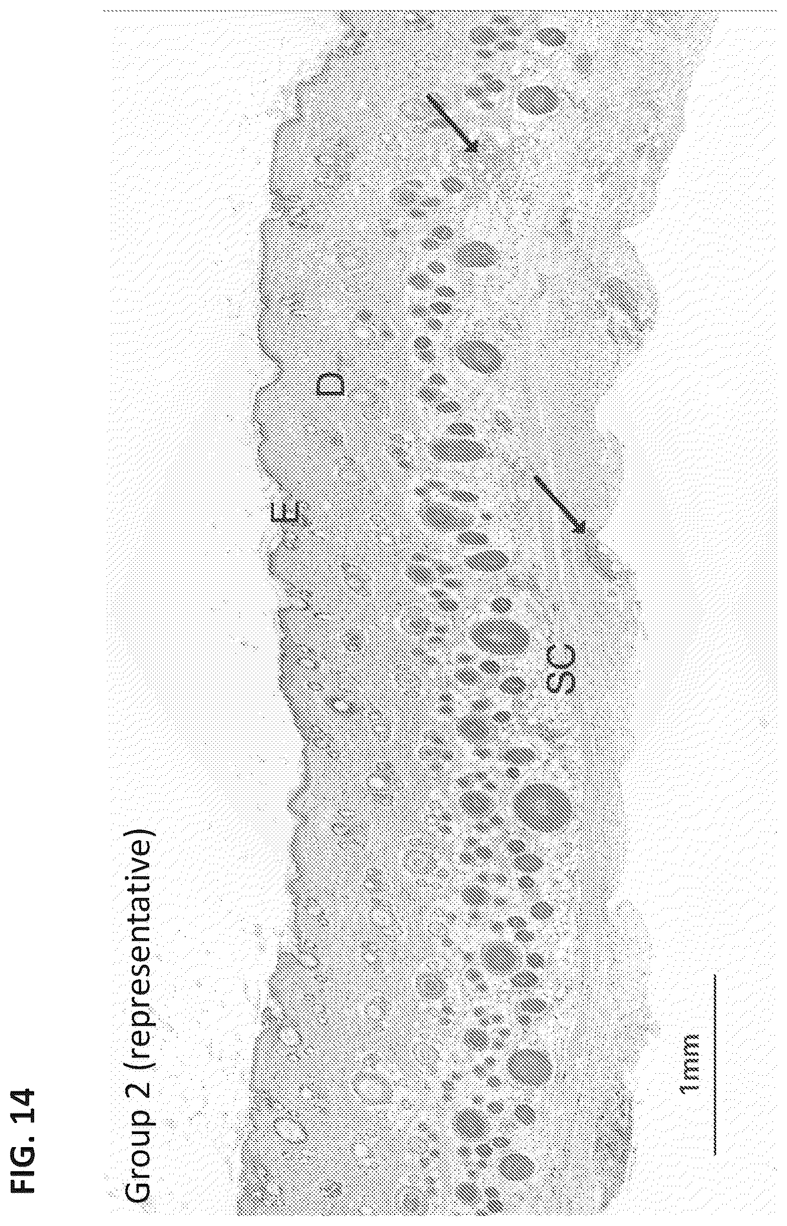 Patent US12324860 Figure 12 – Methods of treating central nervous system disorders via administration of nanoparticles of an mTOR inhibitor and an albumin