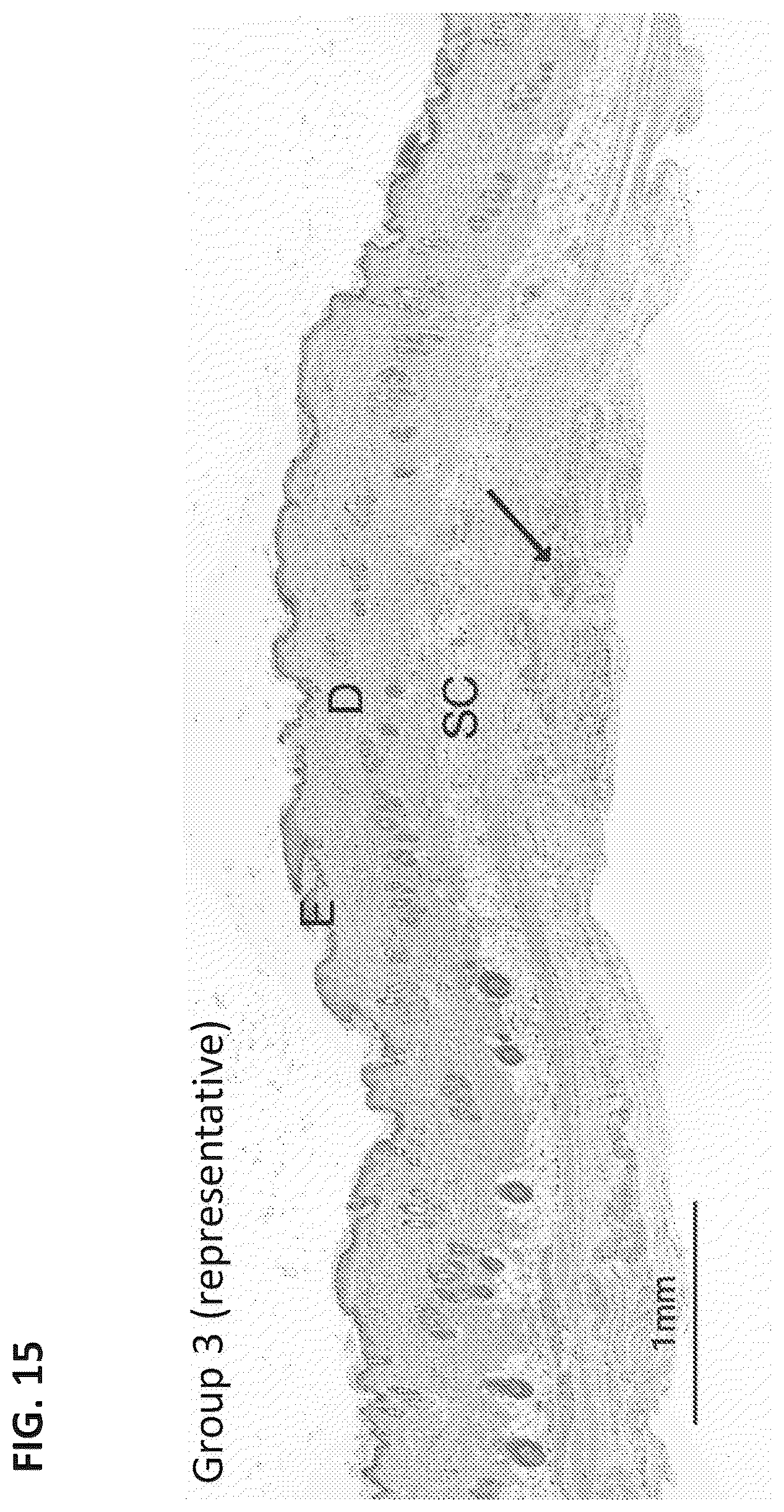 Patent US12324860 Figure 13 – Methods of treating central nervous system disorders via administration of nanoparticles of an mTOR inhibitor and an albumin