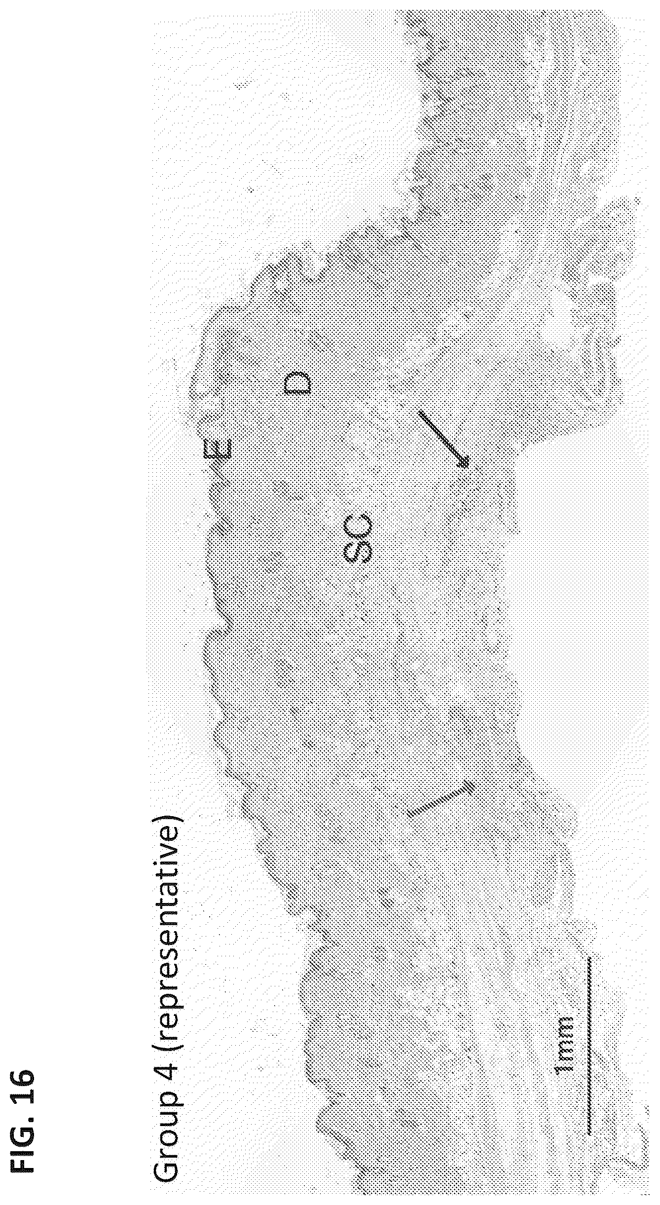 Patent US12324860 Figure 14 – Methods of treating central nervous system disorders via administration of nanoparticles of an mTOR inhibitor and an albumin