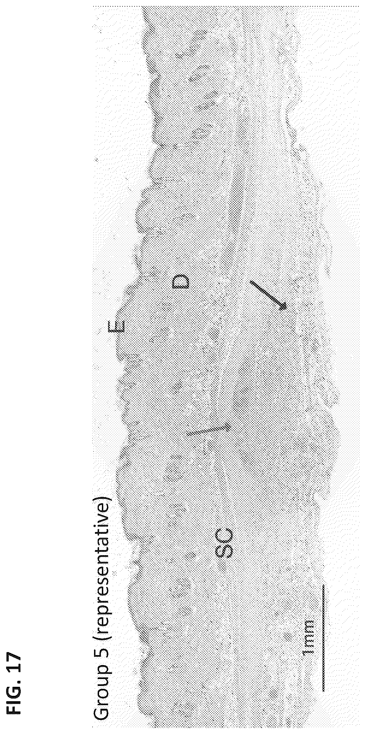 Patent US12324860 Figure 15 – Methods of treating central nervous system disorders via administration of nanoparticles of an mTOR inhibitor and an albumin