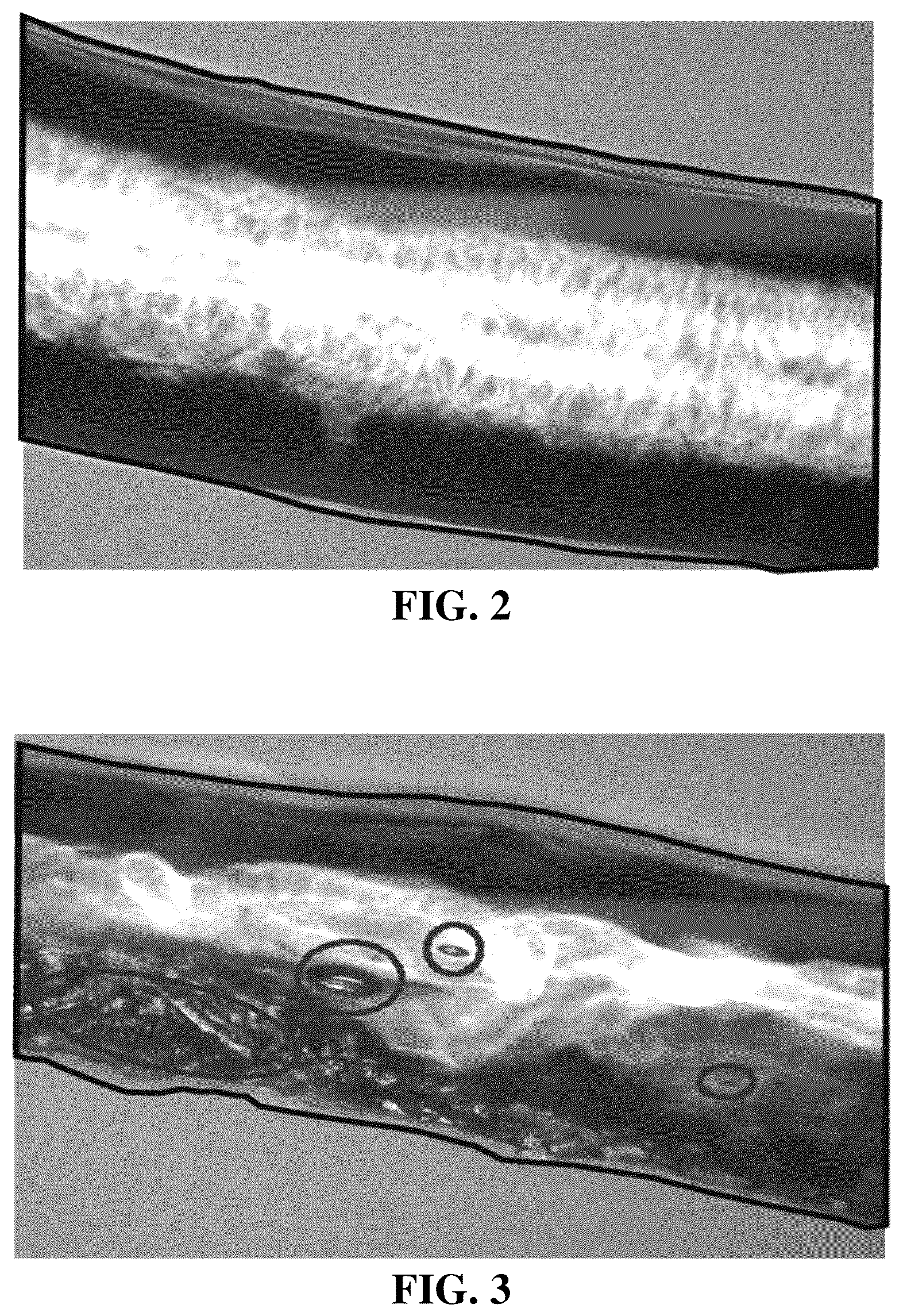 Patent US12324867 Figure 2 – Hyaluronate fiber and manufacturing method thereof
