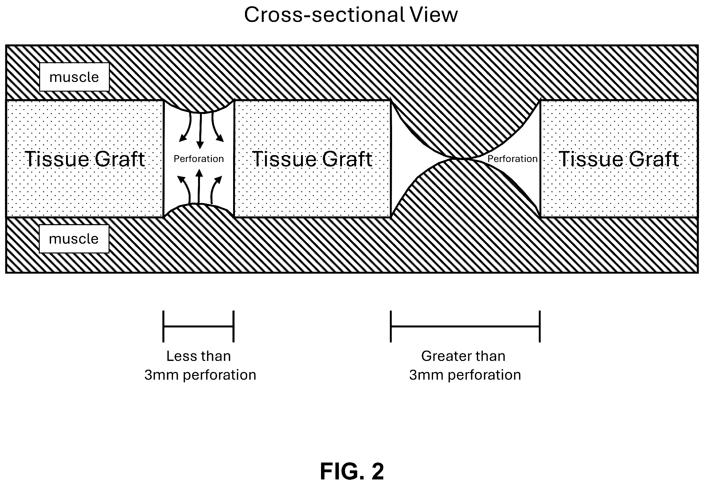 Patent US12324869 Figure 2 – Perforated tissue graft
