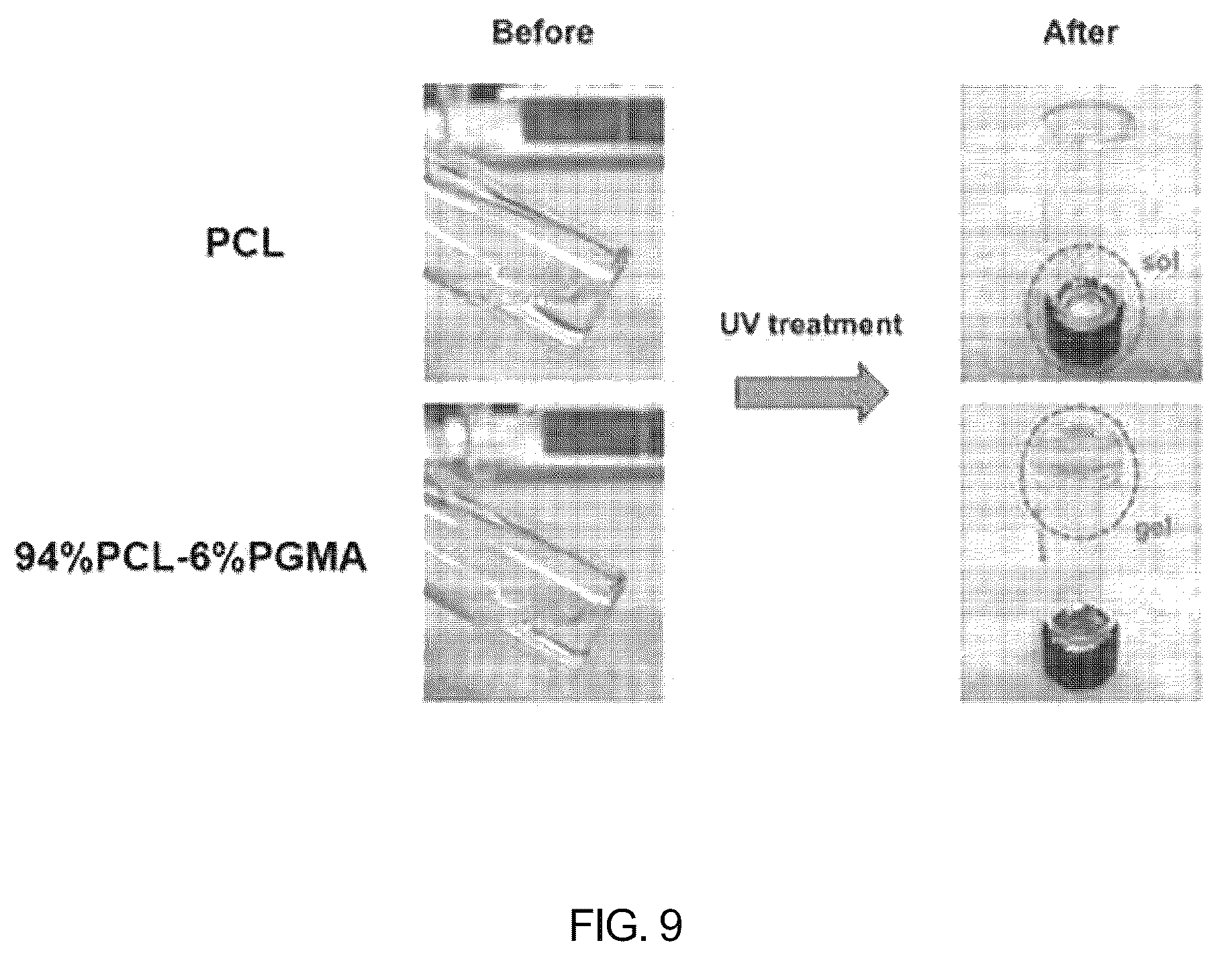 Patent US12324870 Figure 9 – Nasolacrimal duct insertion member comprising shape memory polymer