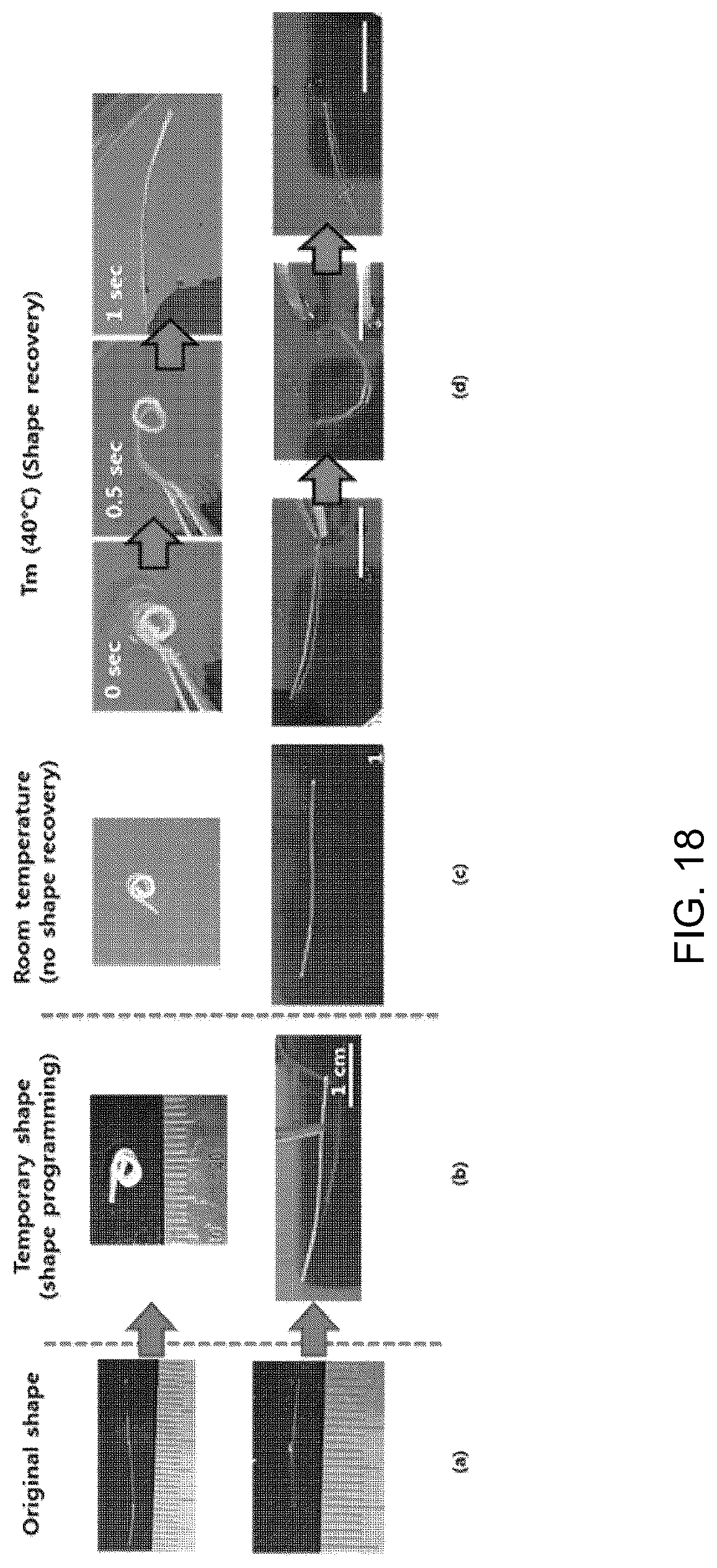 Patent US12324870 Figure 18 – Nasolacrimal duct insertion member comprising shape memory polymer
