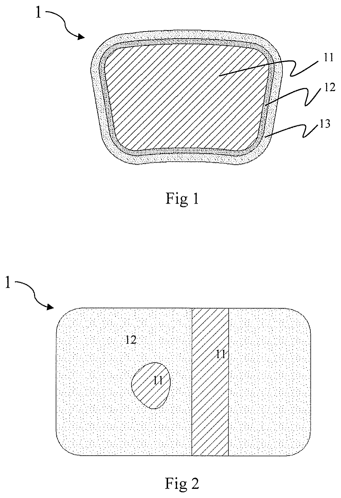 Patent US12324871 Figure 1 – Absorbable iron-based alloy implanted medical device and manufacturing method thereof