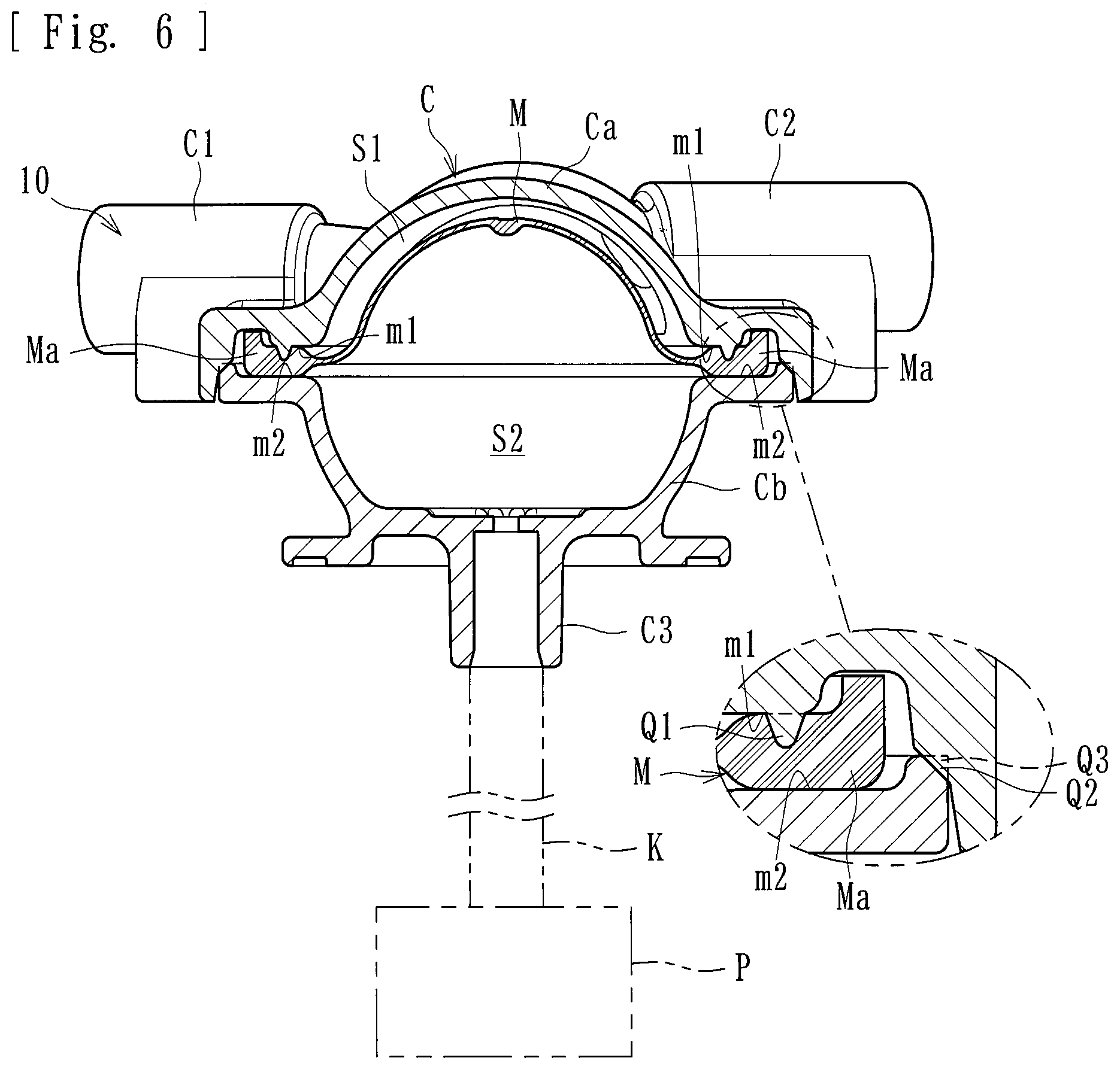 Patent US12324878 Figure 4 – Medical device and method of manufacturing the same