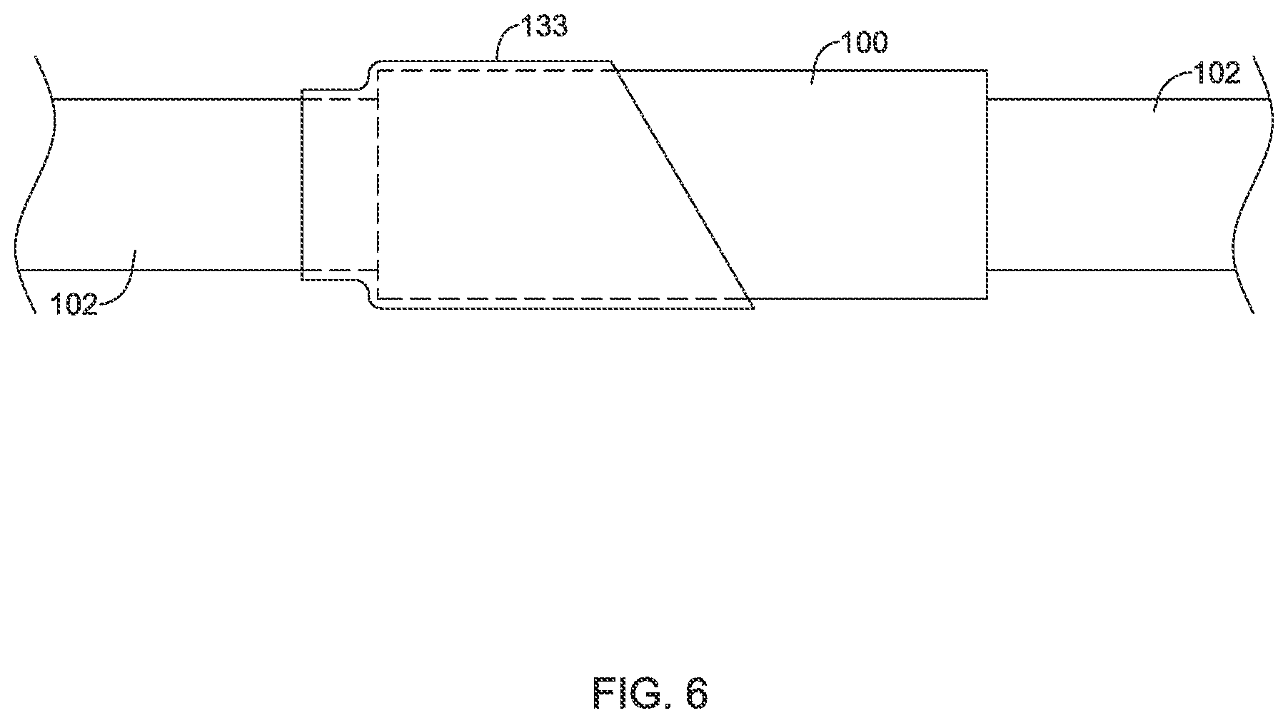 Patent US12324884 Figure 6 – Balloon catheter