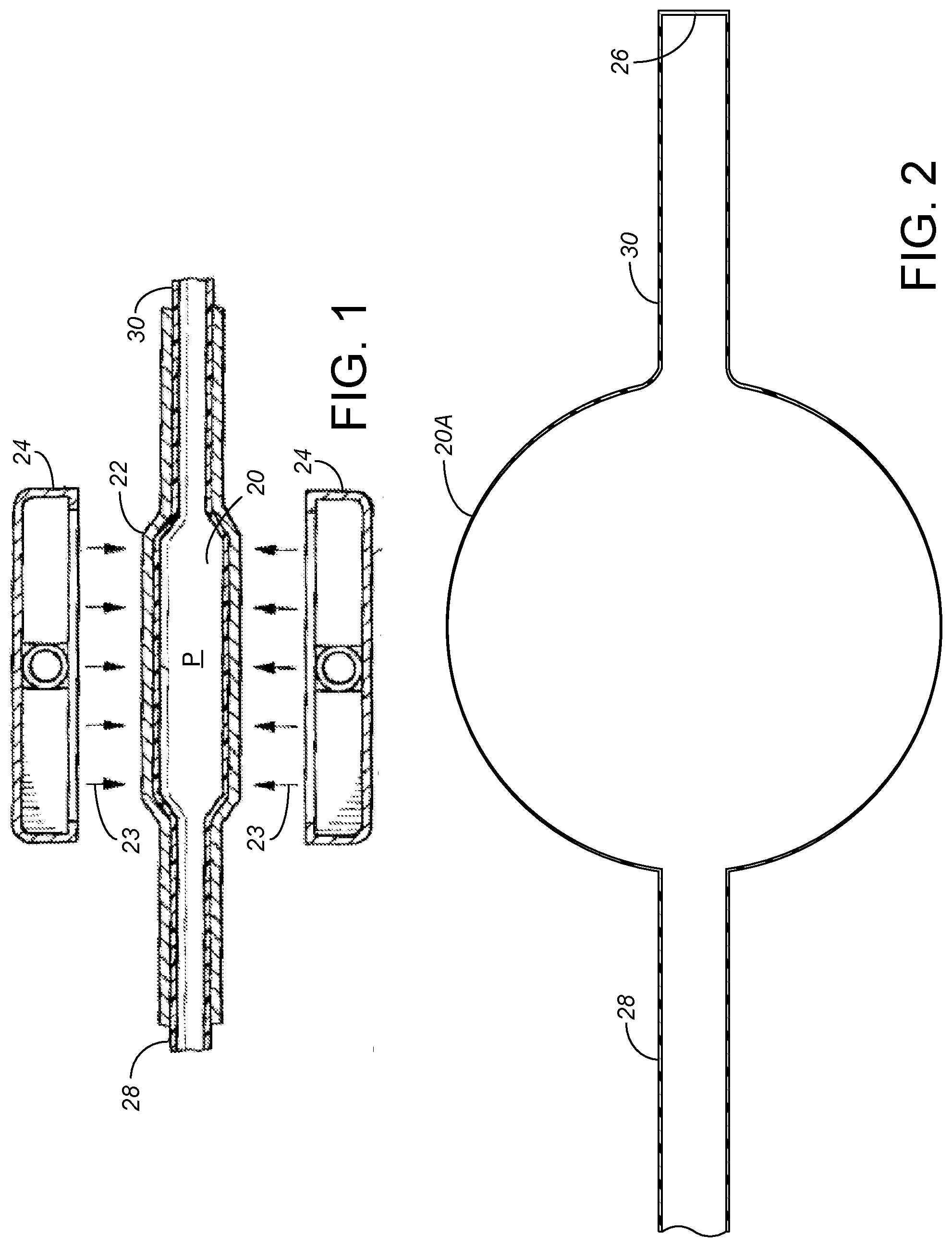 Patent US12324887 Figure 1 – Microminiature patterned metal on medical grade balloons