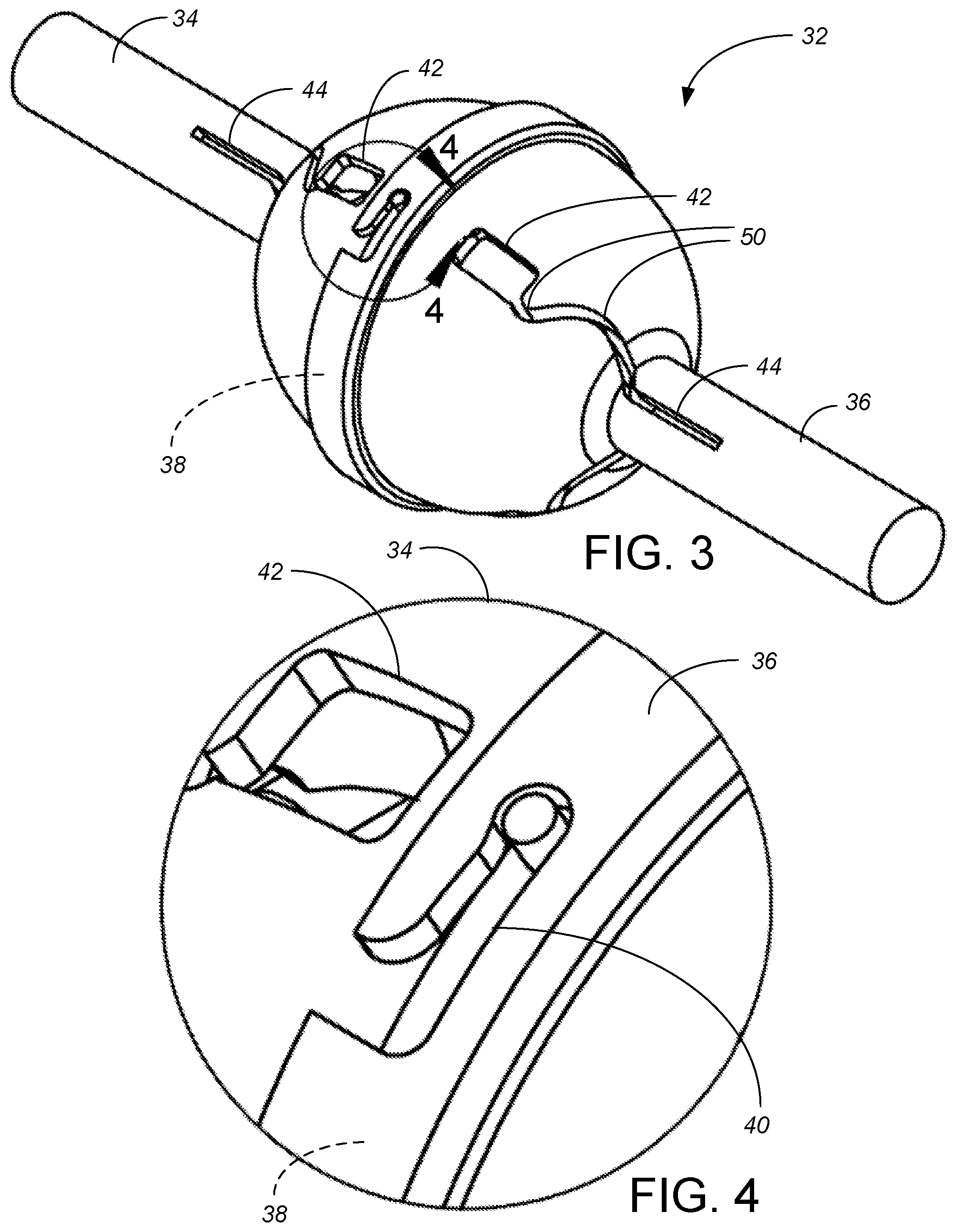 Patent US12324887 Figure 2 – Microminiature patterned metal on medical grade balloons