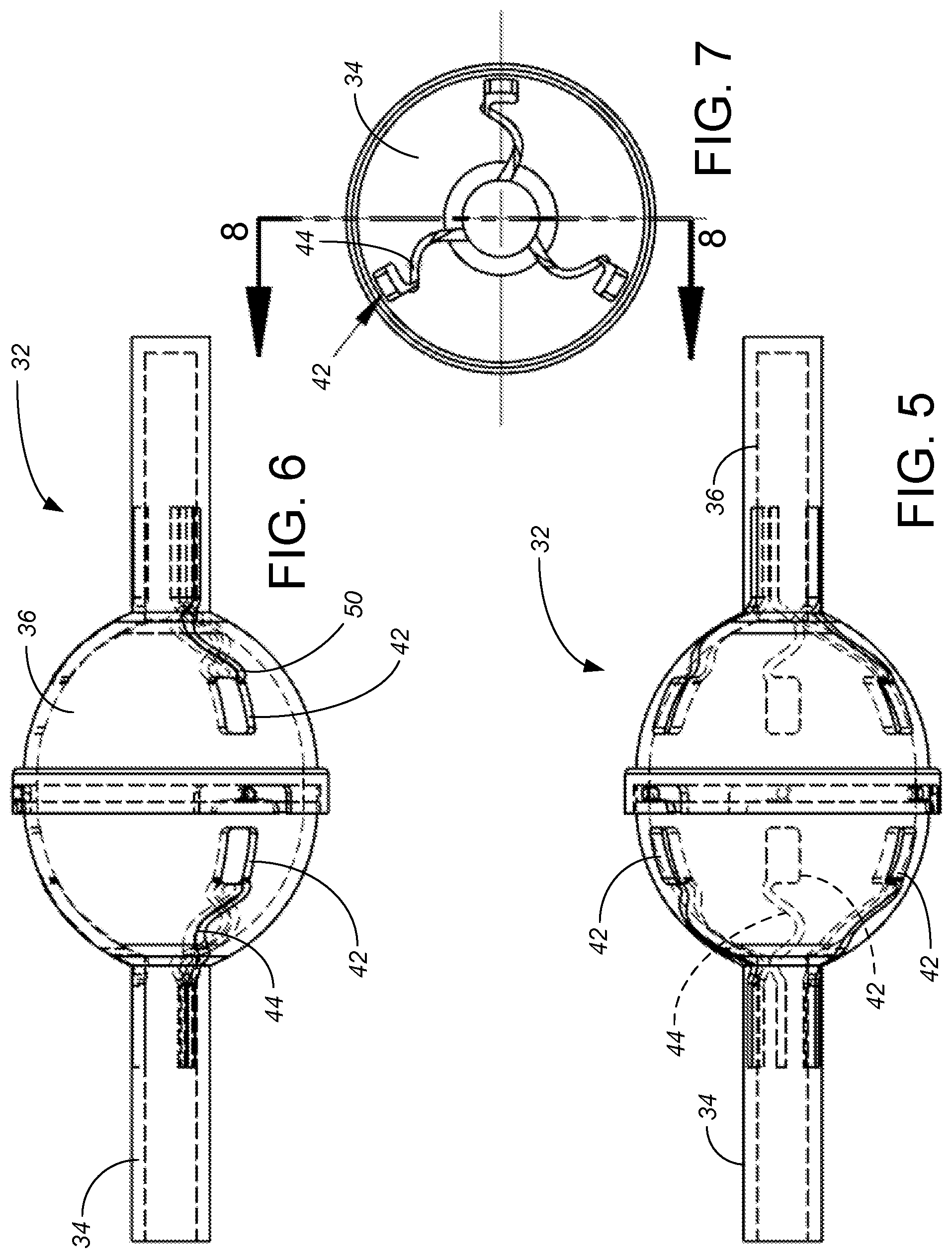 Patent US12324887 Figure 3 – Microminiature patterned metal on medical grade balloons