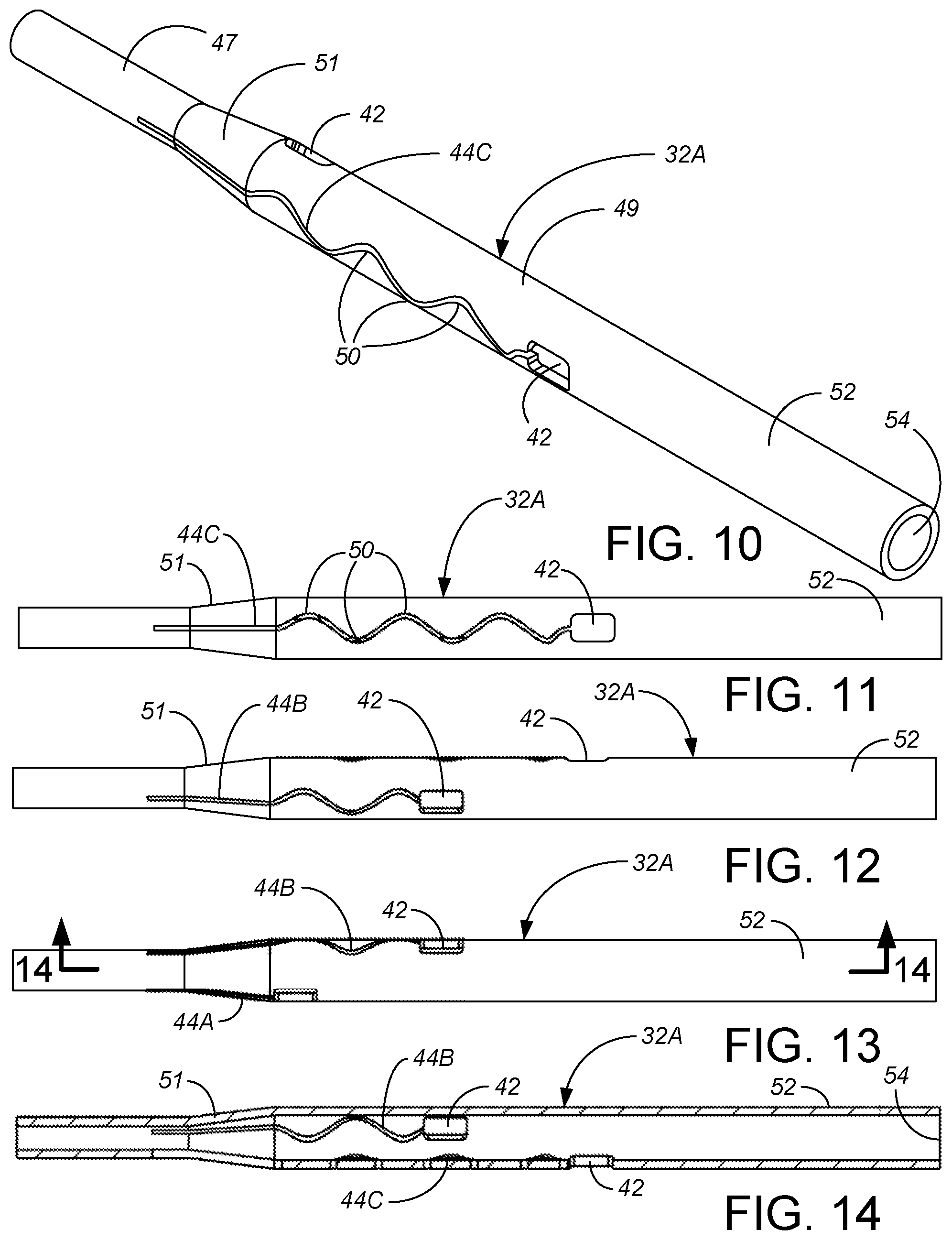 Patent US12324887 Figure 5 – Microminiature patterned metal on medical grade balloons