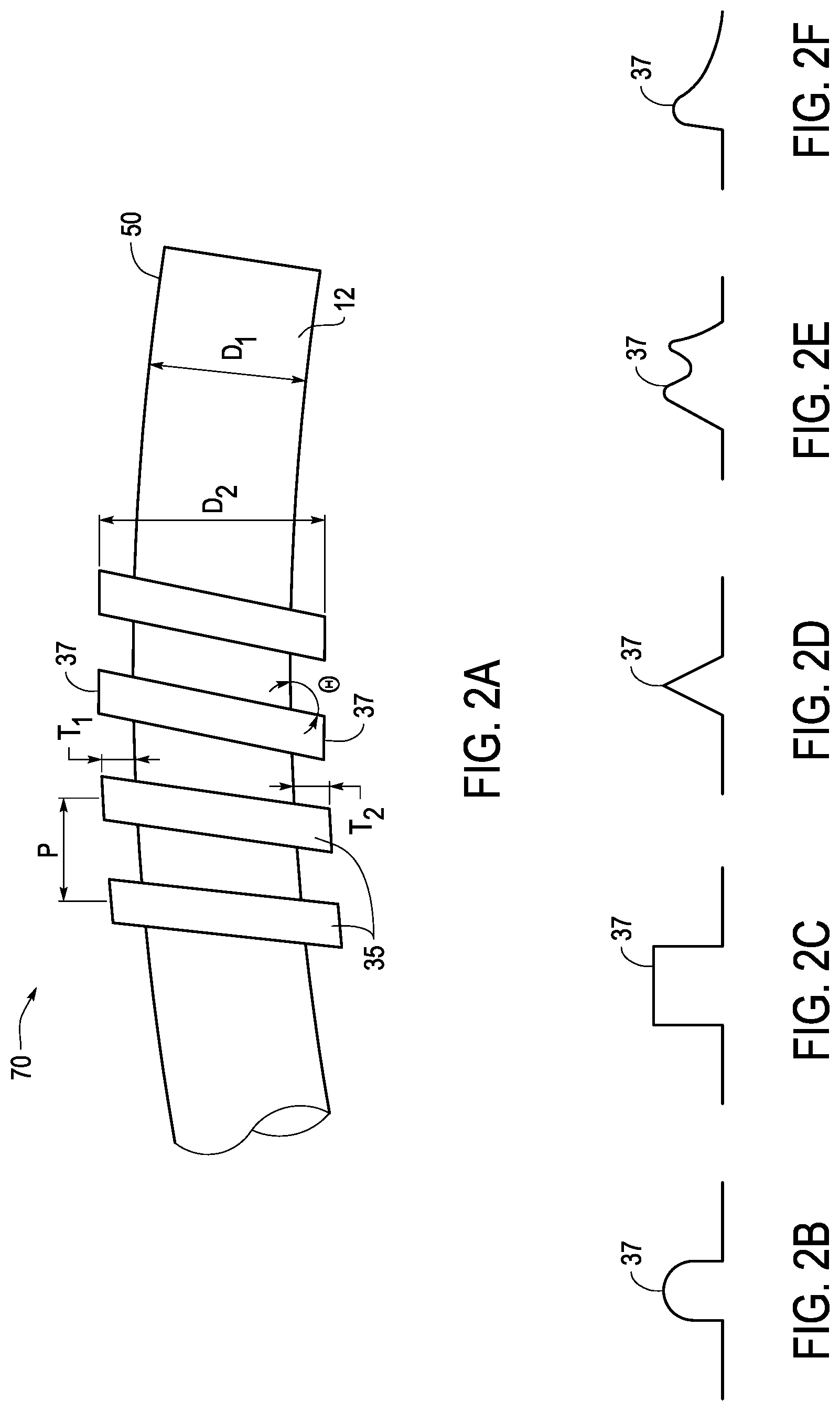 Patent US12324888 Figure 3 – Ureteral stent with anti-migration features