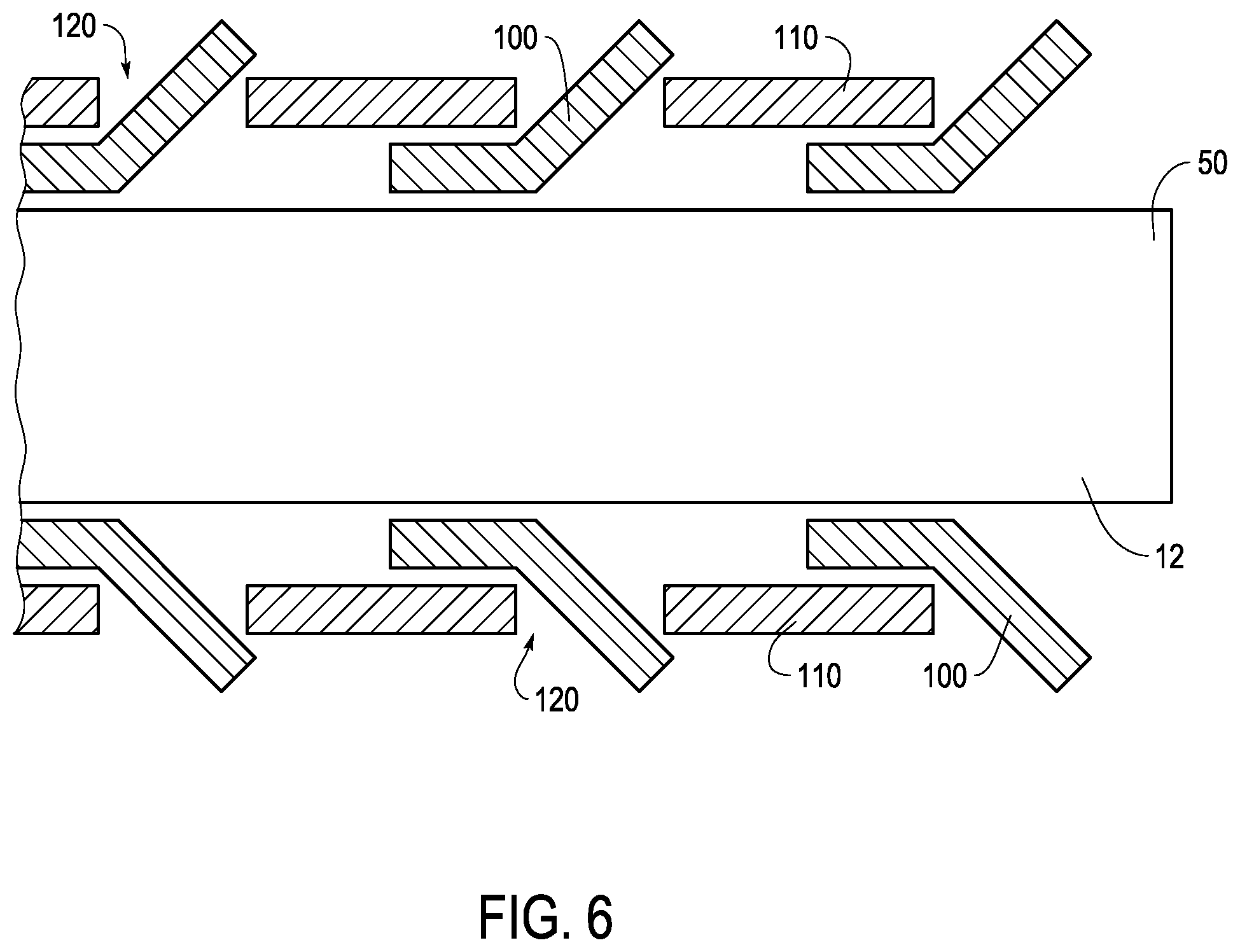 Patent US12324888 Figure 6 – Ureteral stent with anti-migration features