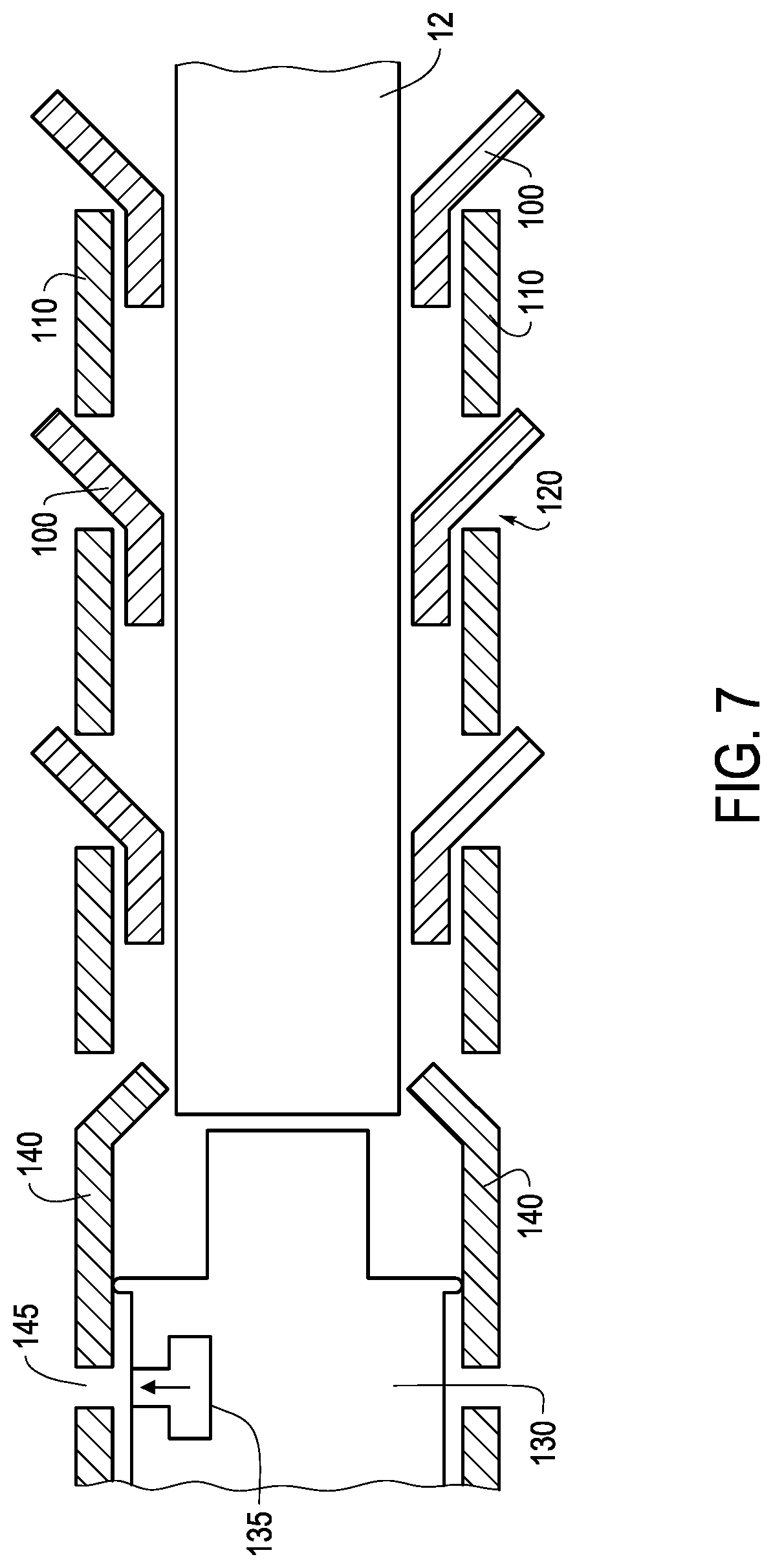Patent US12324888 Figure 7 – Ureteral stent with anti-migration features