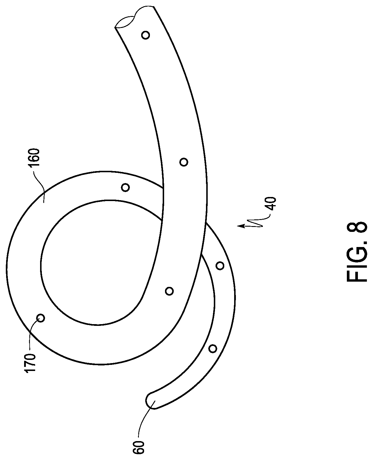 Patent US12324888 Figure 8 – Ureteral stent with anti-migration features
