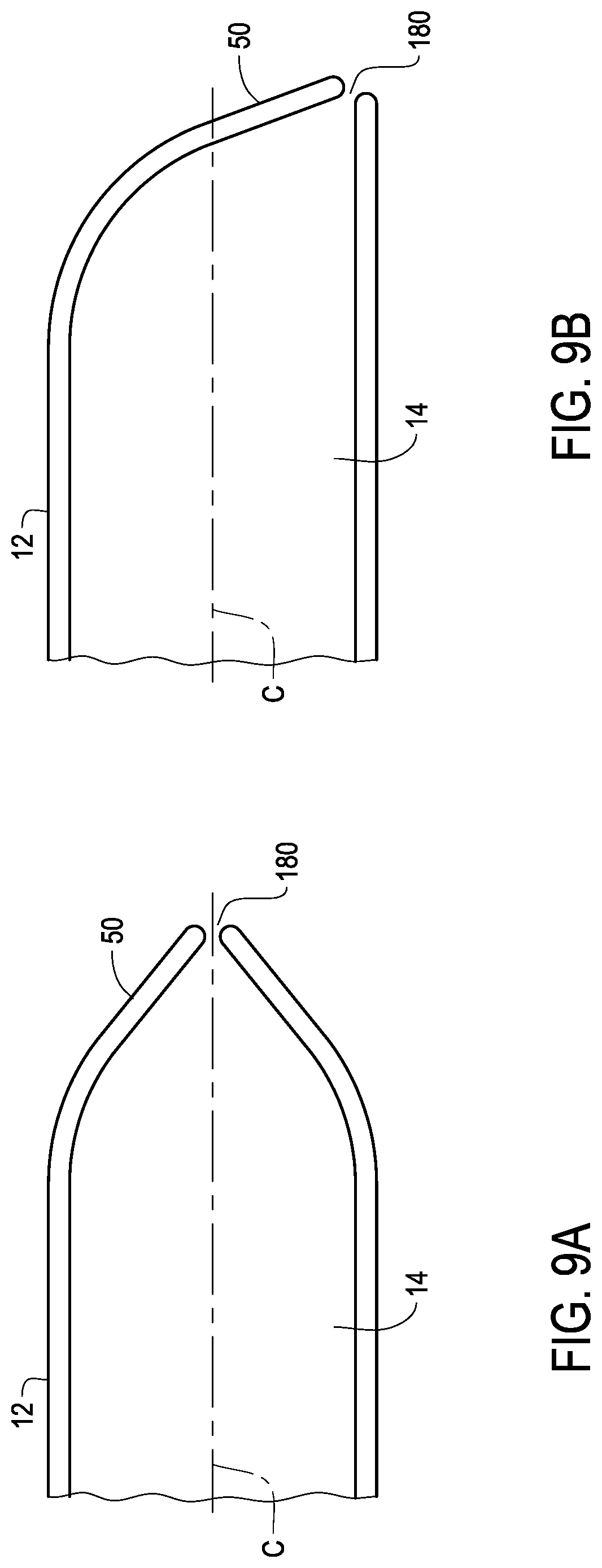 Patent US12324888 Figure 9 – Ureteral stent with anti-migration features