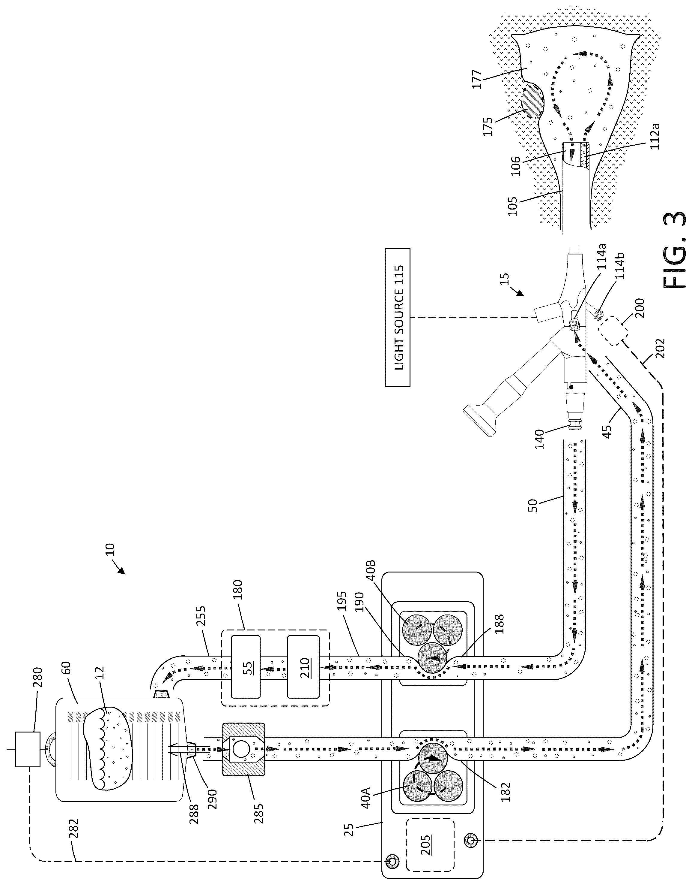 Patent US12324889 Figure 2 – Fluid management system and methods