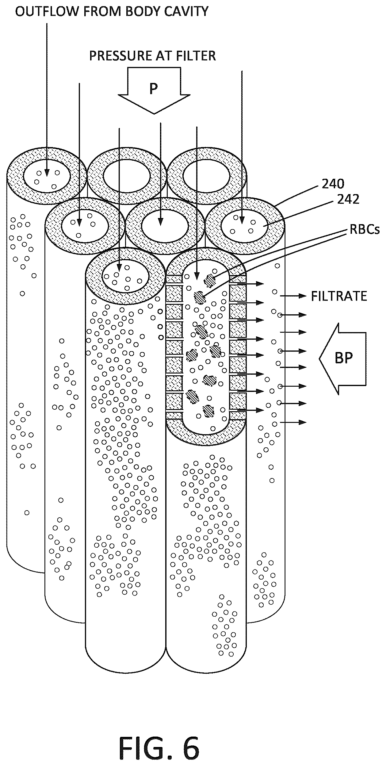 Patent US12324889 Figure 5 – Fluid management system and methods